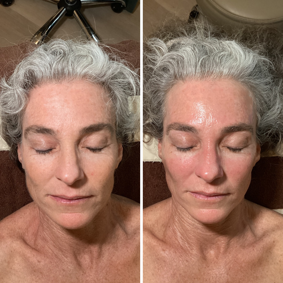 Deluxe HydraFacial + Dermaplaning