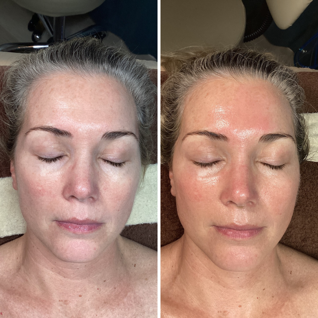The Opal Signature Facial