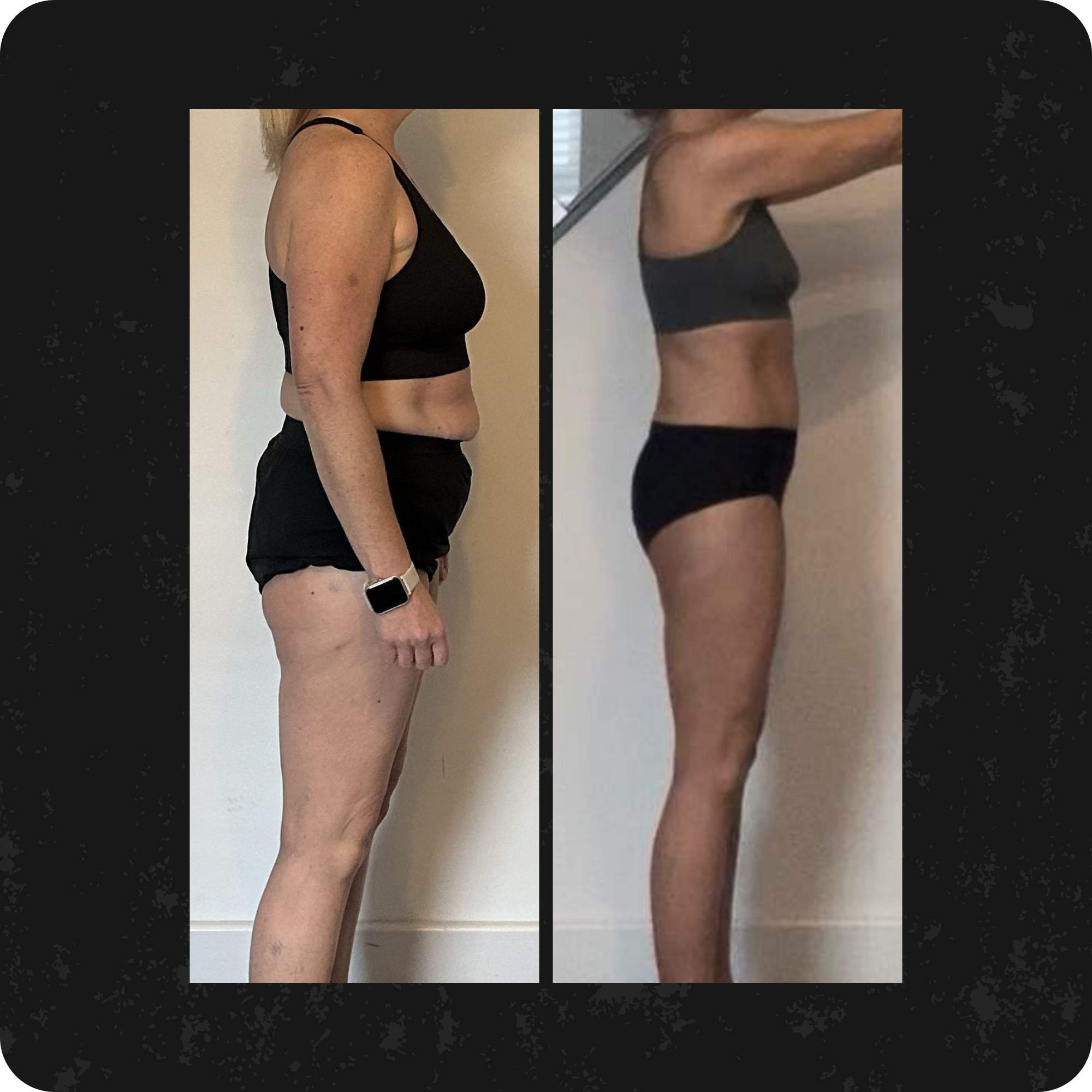 Comparison of a woman's body before and after fitness transformation, side profiles showing changes in muscle tone and body shape.
