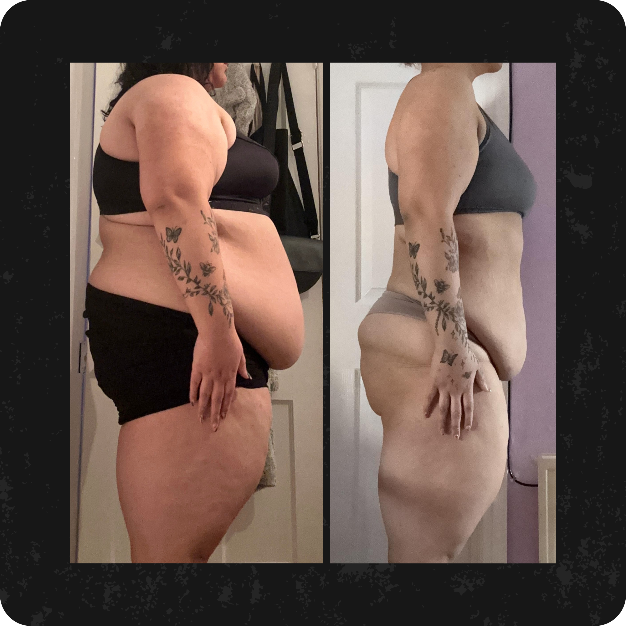 Side-by-side comparison of a woman showing weight loss progress, wearing a black sports bra and black underwear in the first image, and a maroon sports bra and black underwear in the second image, with marked reduction in body size and stretch marks visible.