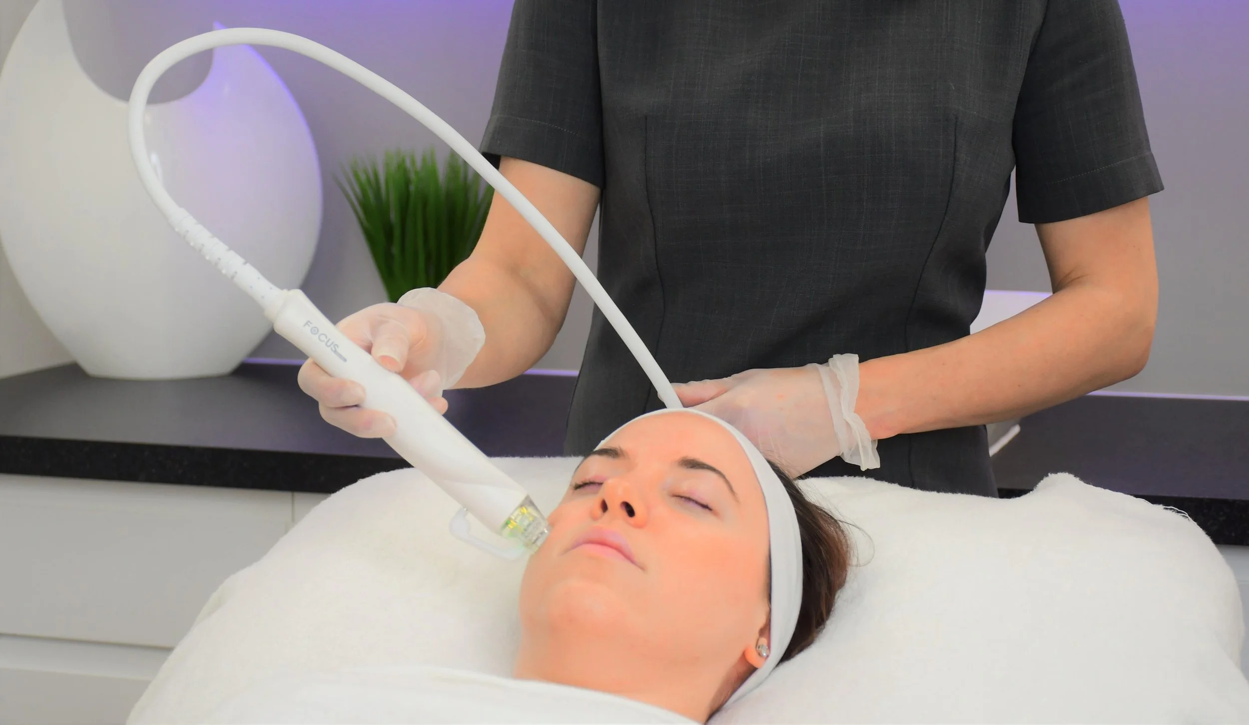 Radiofrequency Microneedling