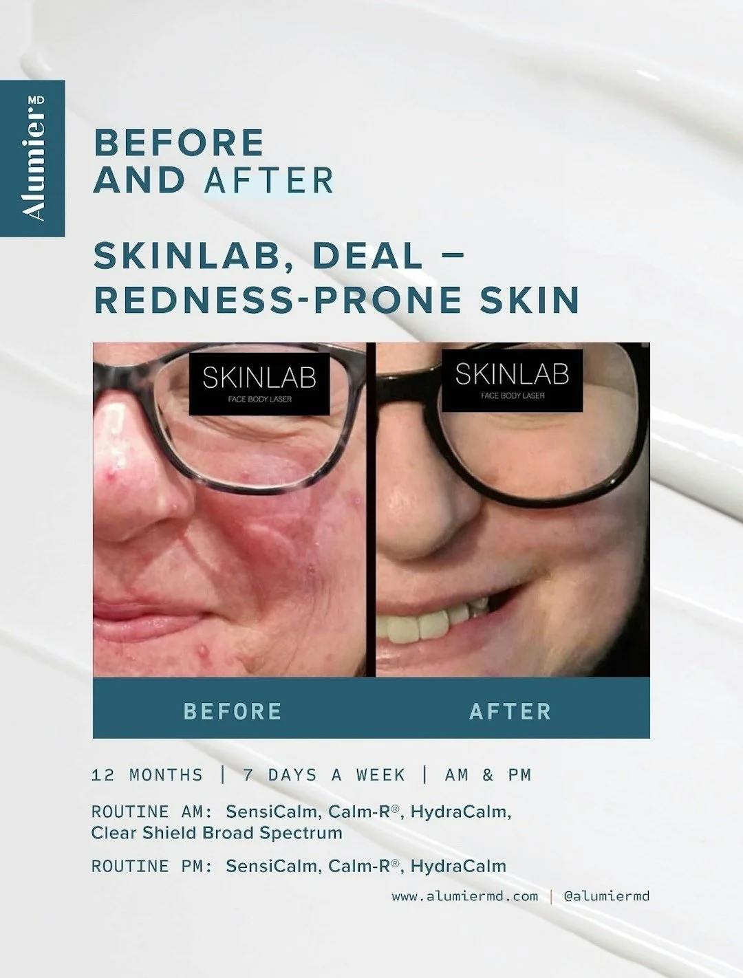 Before &amp; Afters [shared images]