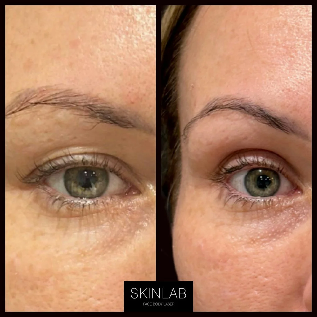 NeoGen Plasma [Results]