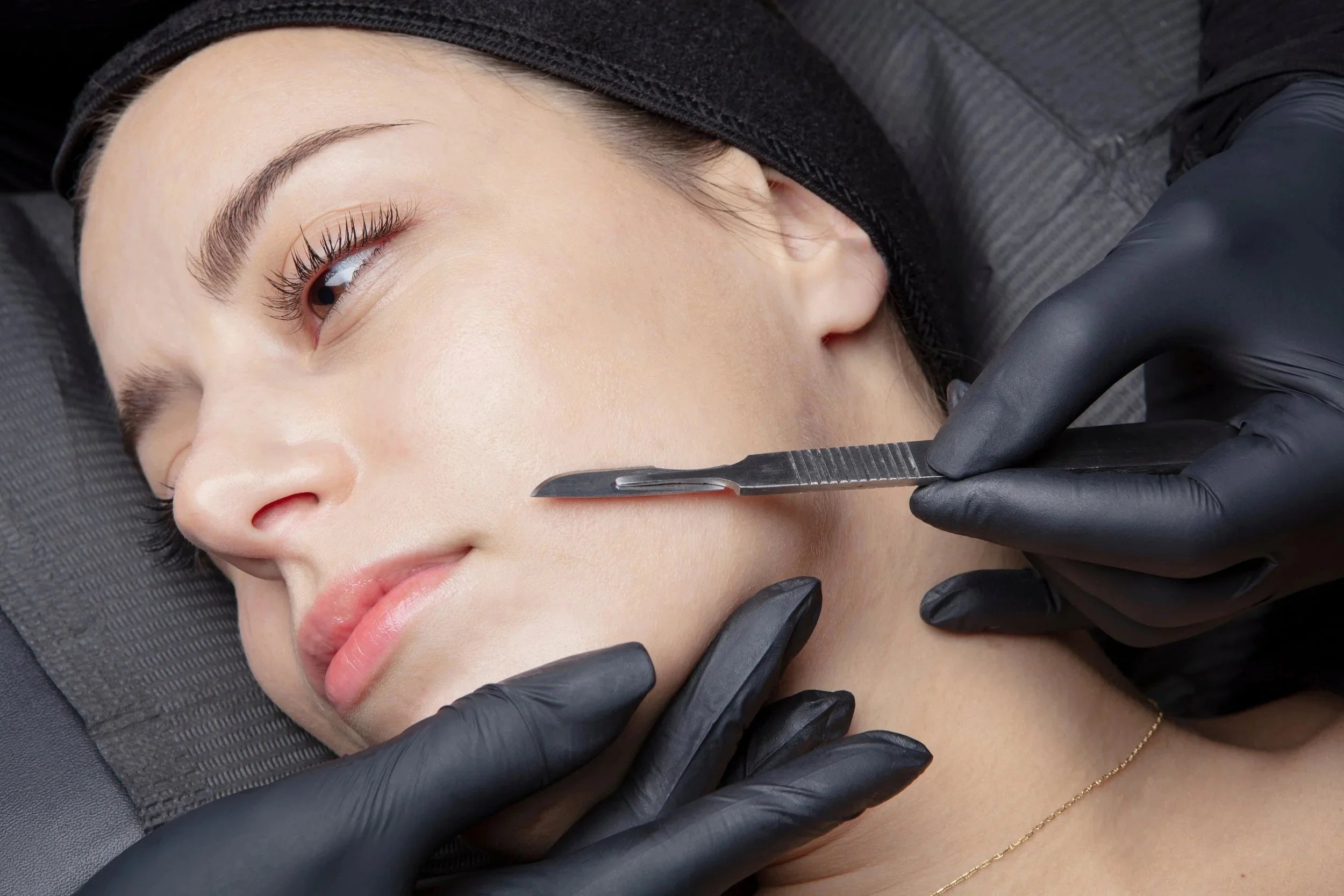 Dermaplaning+.jpeg