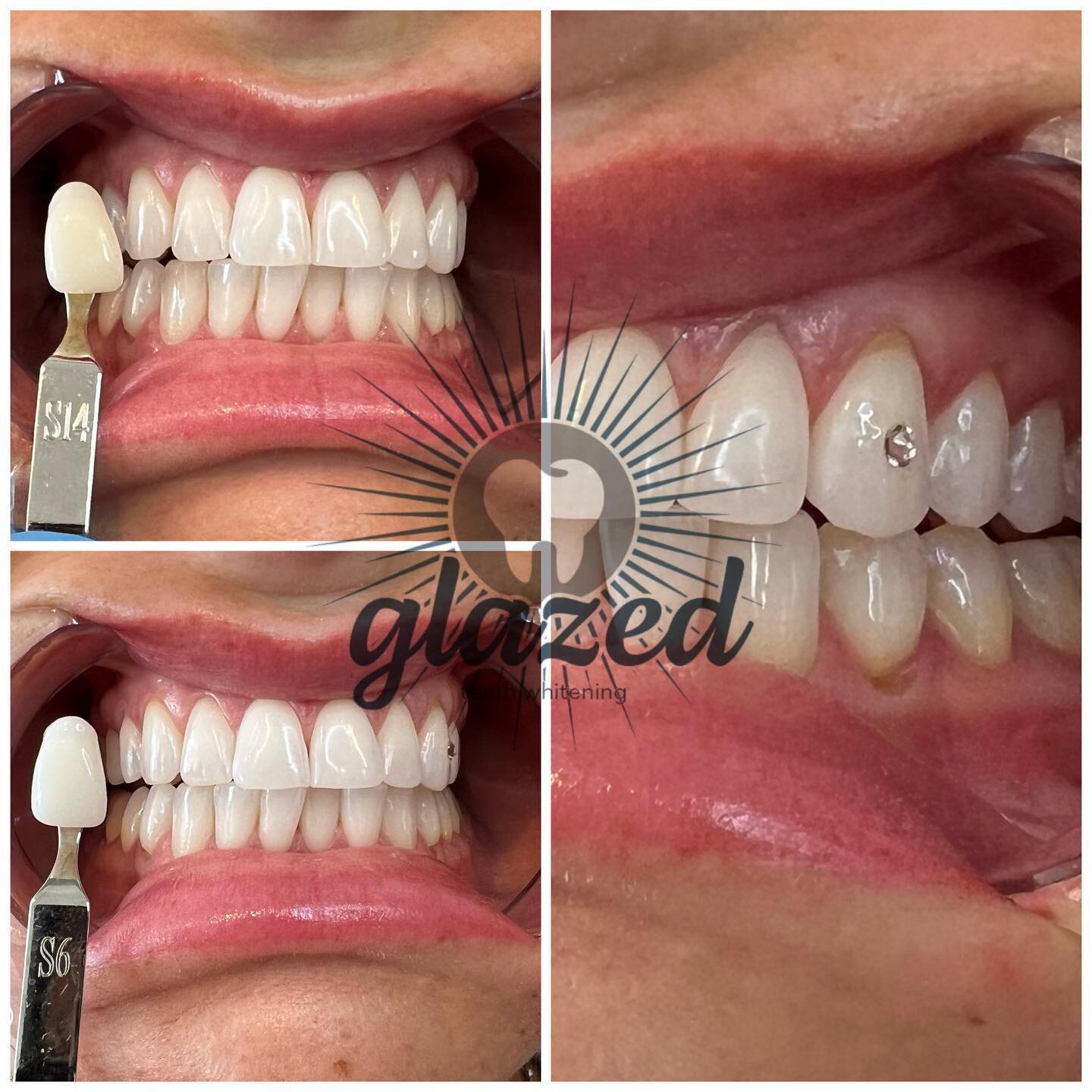 @glazedwhitening on Sundays at Lush Beauty Bar ✨ 

Holidays and amazing festivities coming up this fall, get picture perfect! 

Add a tooth gem for that extra sparkle 😍

DM @glazedwhitening to schedule or book online 🪄

#whiteteethelmwoodpark #teet