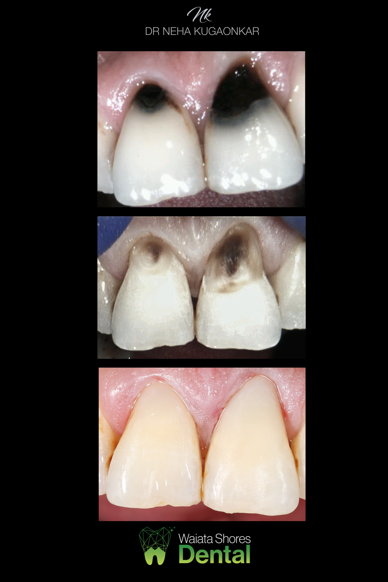 Waiata Shores Dental Before After00024.png