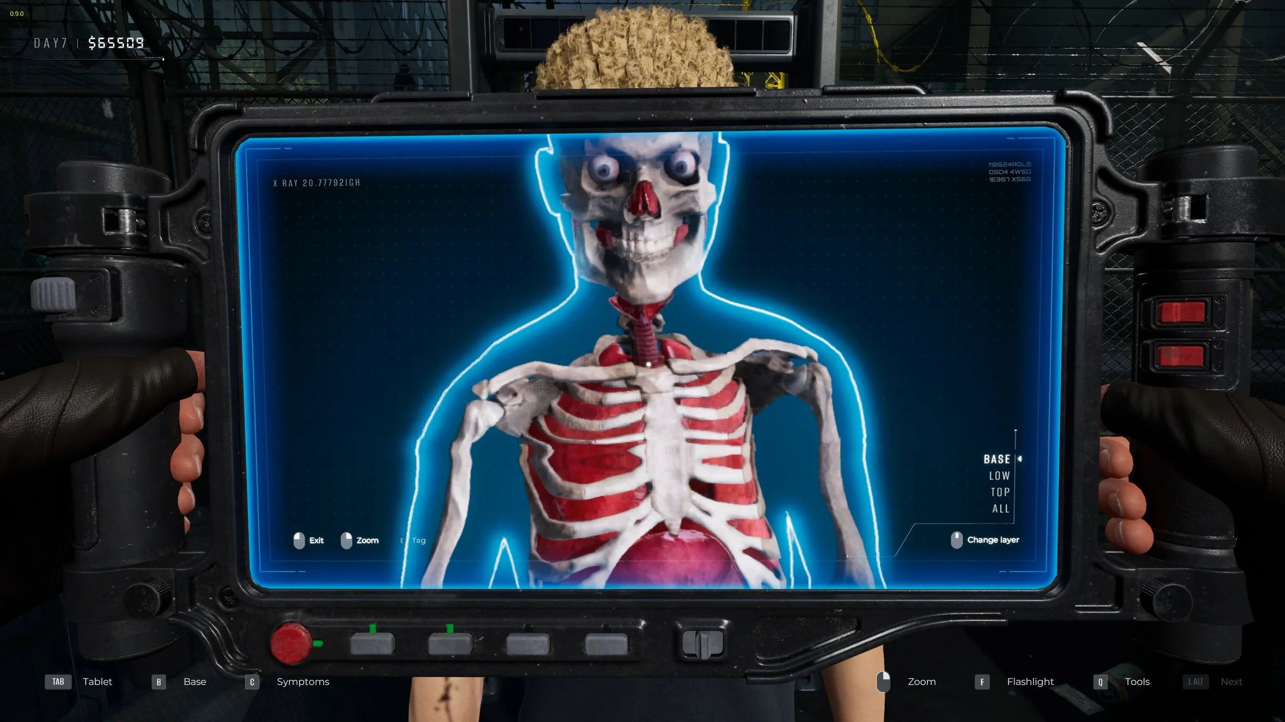 01_XRAY.jpg