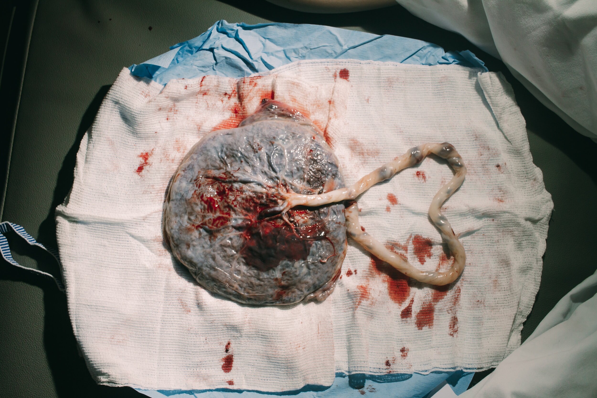 Musings of Motherhood and Maryn’s frozen Placenta…