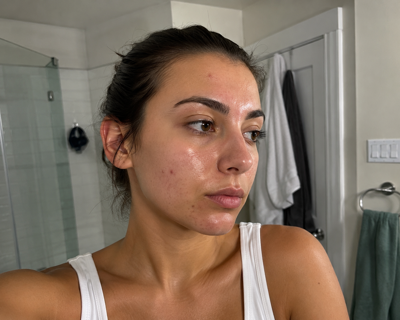 Summer Acne: Why You Break Out More in the Heat(And What Actually Helps)