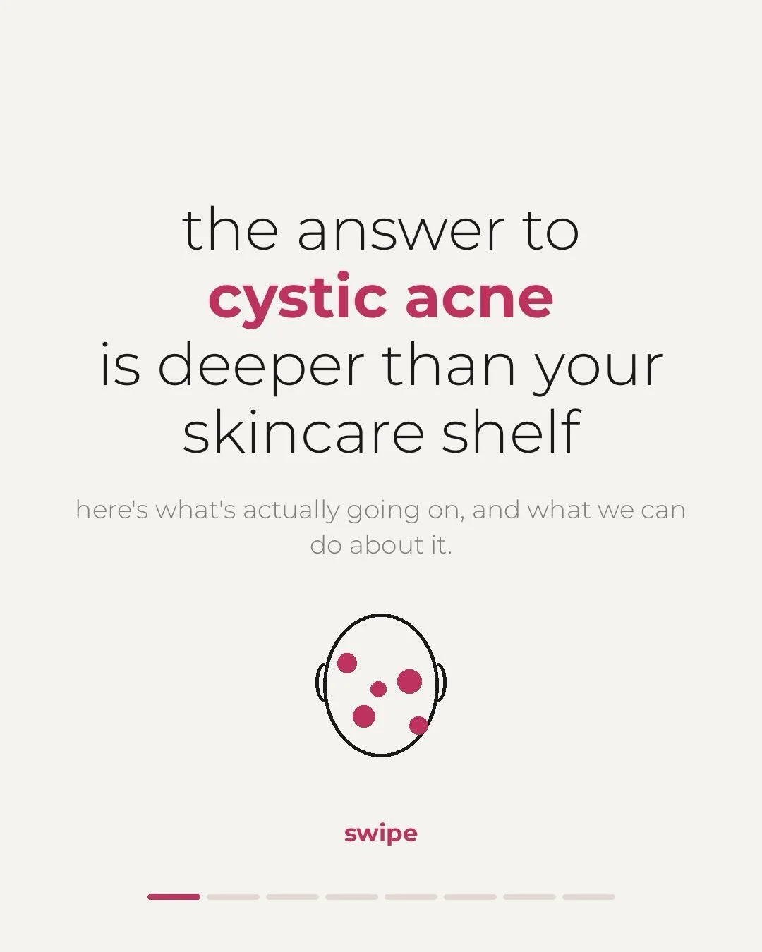 Cystic acne is one of the most frustrating skin condition to treat.

Deep below the surface, products just can' t reach, it really requires a holistic approach.

It's also not your skincare routine. It's usually hormones, insulin, inflammation or gen