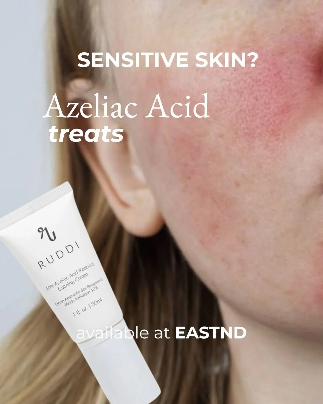 Azelaic acid is a dicarboxylic acid that works on several skin concerns at once. 

It&rsquo;s well tolerated, which makes it a useful choice when stronger actives aren&rsquo;t suitable.

What it does

↪Antibacterial: it reduces C. acnes without creat