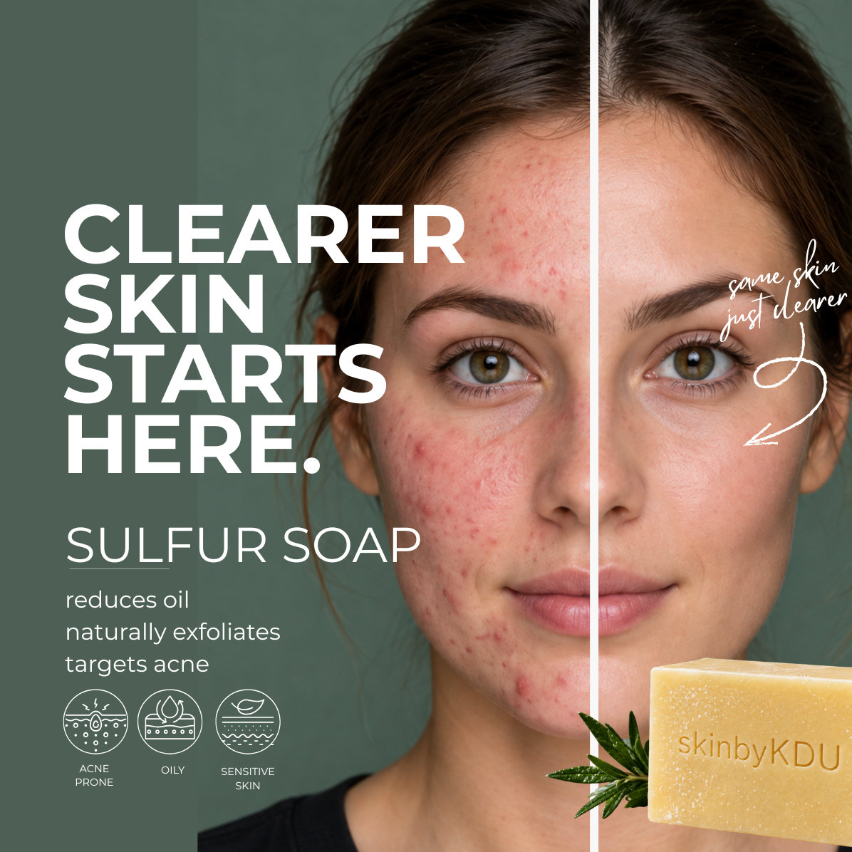 Sulfur Soap