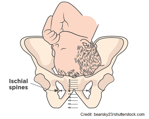 Understanding Cervical Exams: Your Guide to Dilation, Effacement, and ...