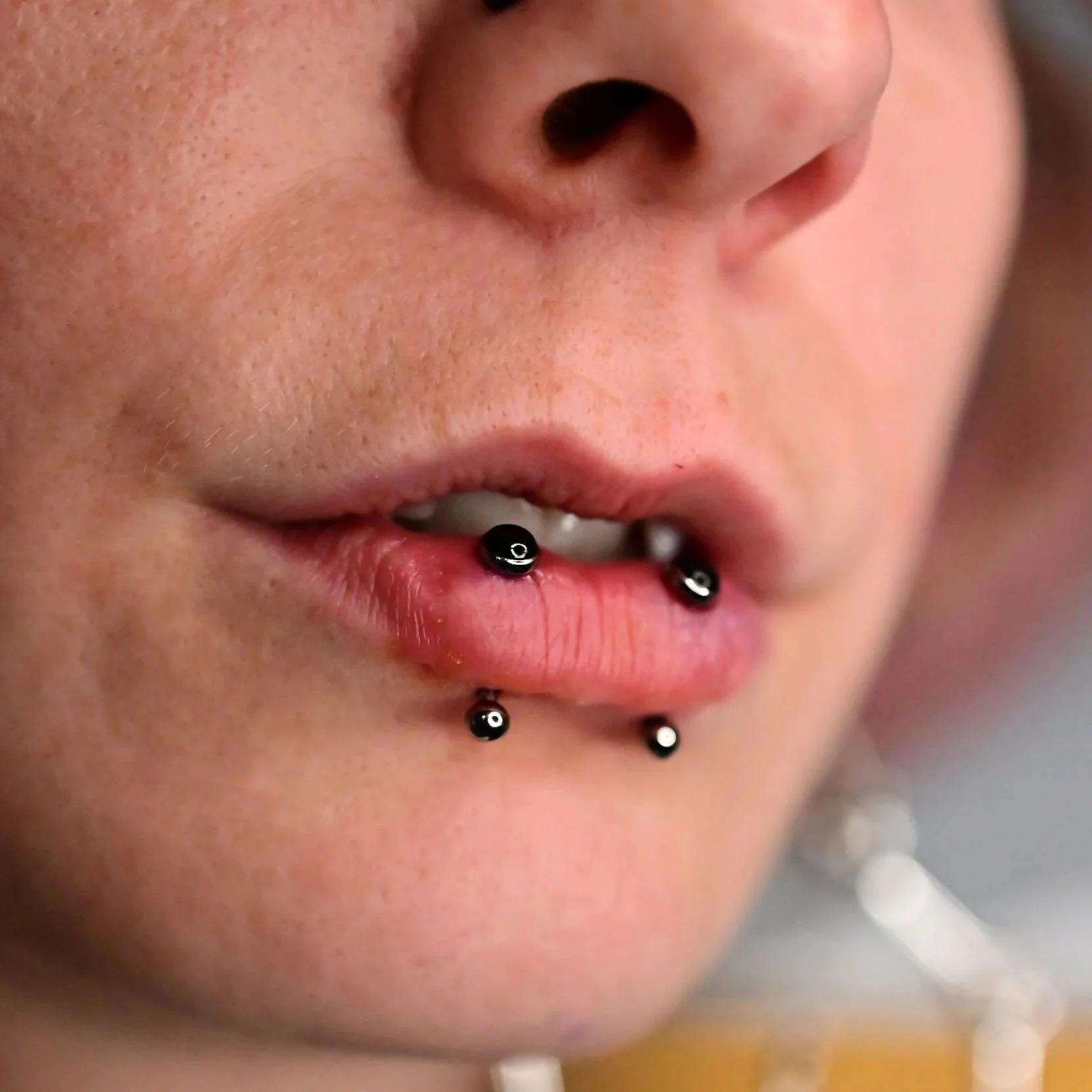 double vertical labret piercing, vertical labret, titanium jewelry, curved barbell, black jewelry, onyx cabochon, calgary piercing, piercings by dee, dee piercing calgary, titanium ball, lip piercing, oral piercings, 16g jewelry, threadless jewelry, 