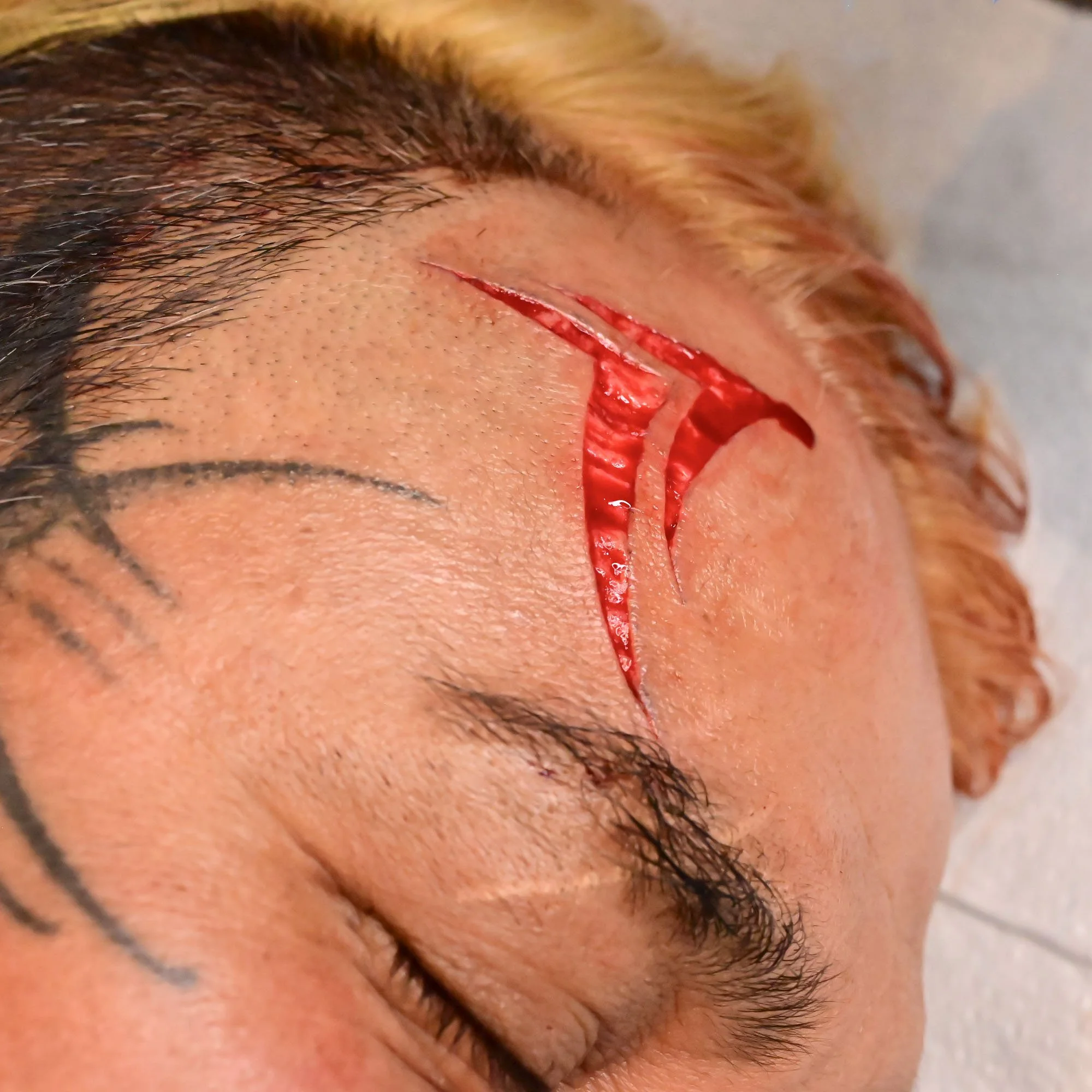 facescar.jpg