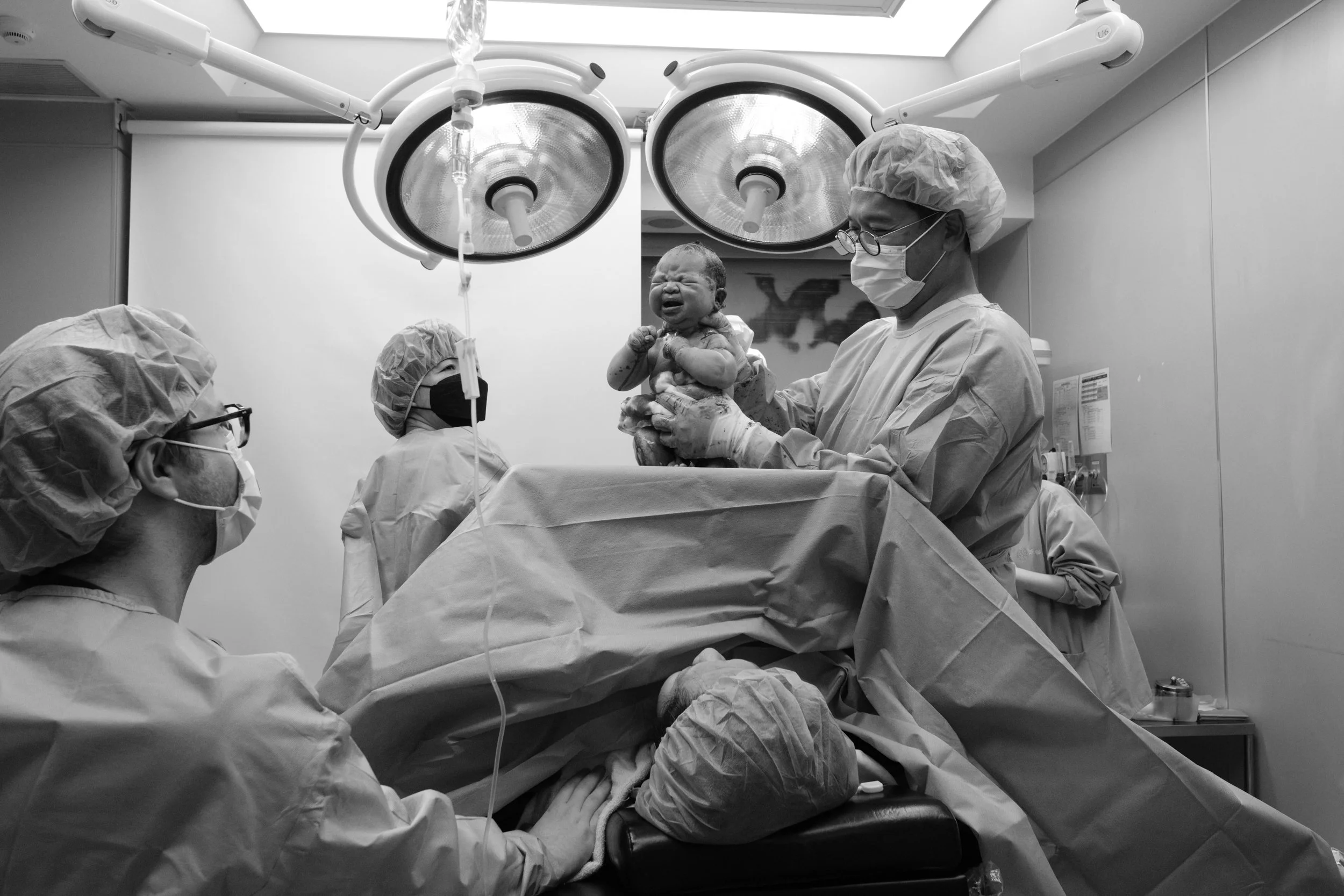 C-section birth photography at Dianthus Taipei — newborn baby lifted by the doctor moments after delivery, crying under the operating room lights.