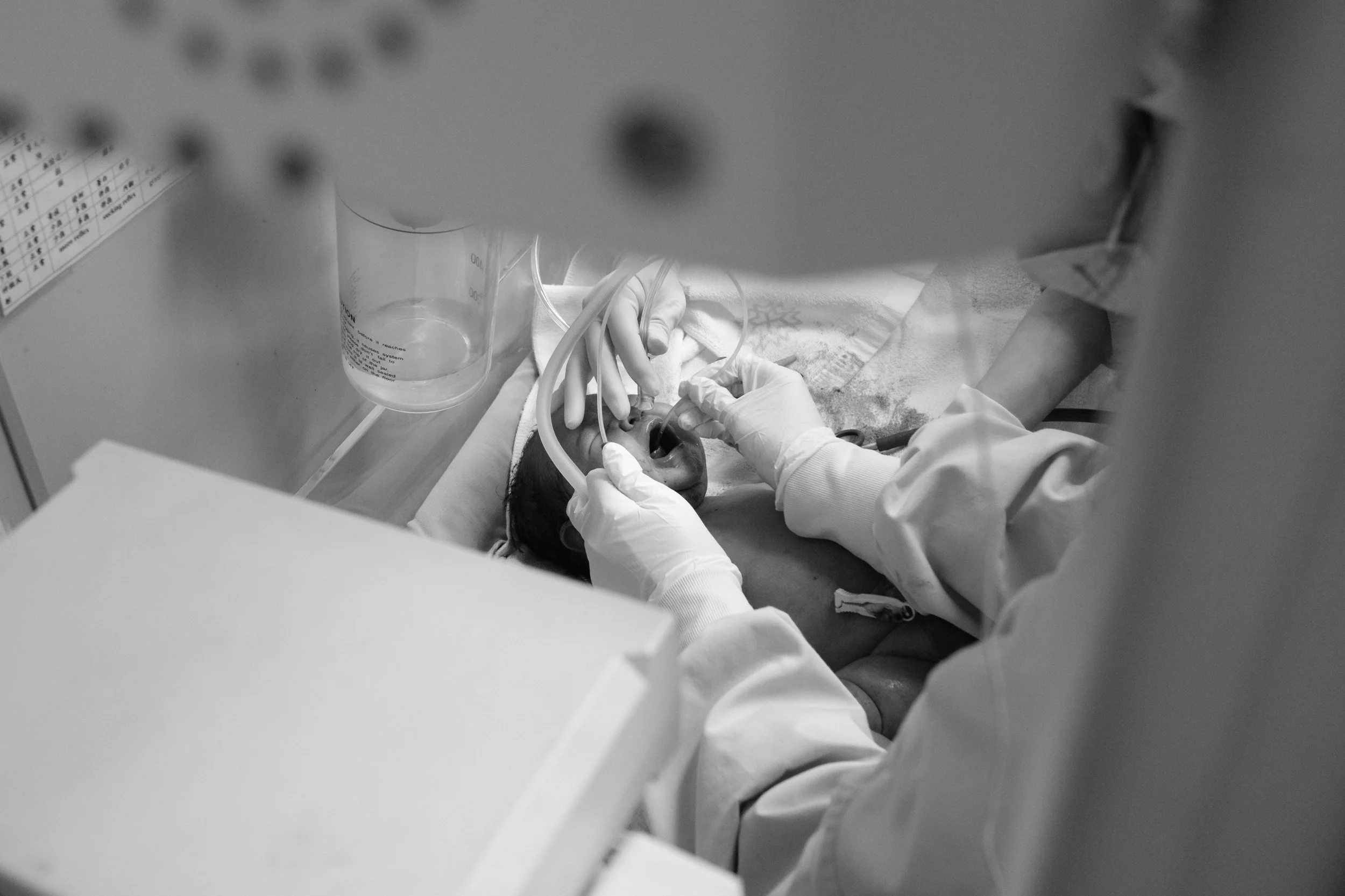 Documentary birth photography Taipei — medical staff suctioning newborn's mouth and nose immediately after c-section delivery.