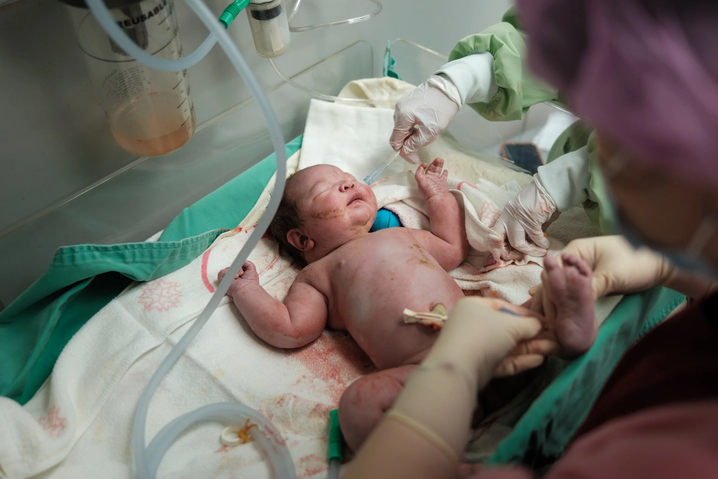 Birth photography at Dianthus Taipei — newborn baby on warming table receiving a vitamin K injection after c-section birth.