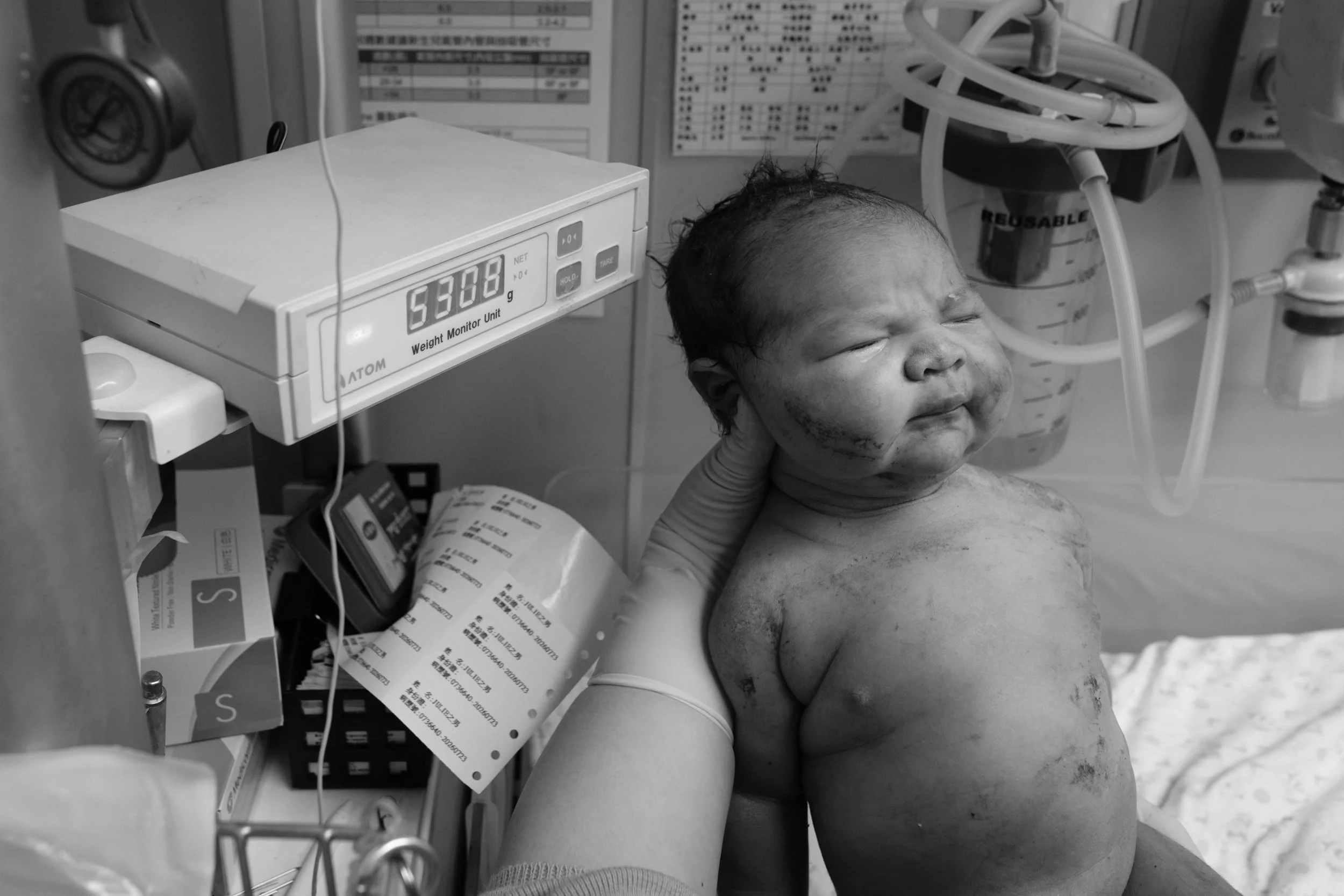 C-section birth photography Taipei — newborn being weighed on the hospital scale, showing birth weight in grams.