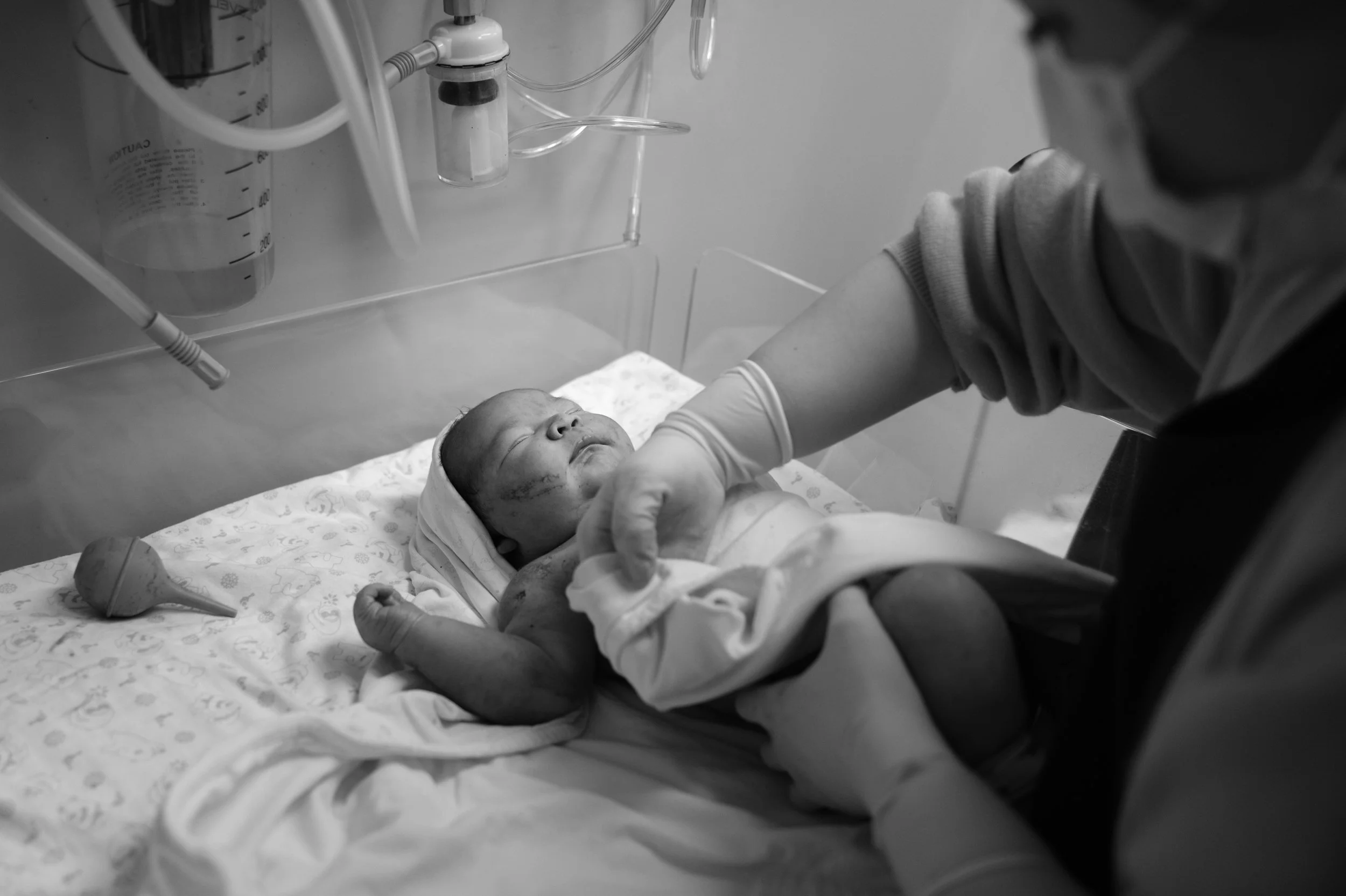 Black and white birth photography image of a newborn being examined on a warming table at Dianthus after a c-section, a nurse's hand reaching in.