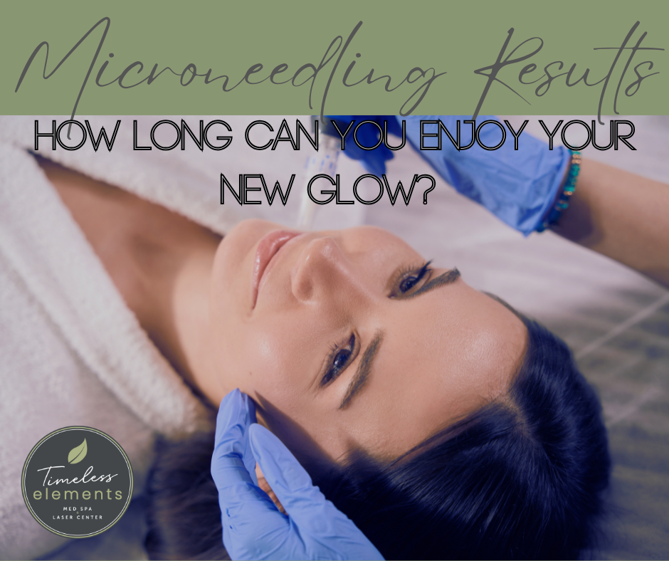 How Long Does Microneedling Last? — Timeless Elements