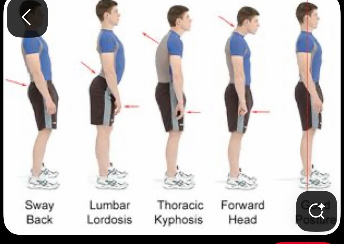 Posture is not just the matter of how we look, it indicates your physical, emotional well being