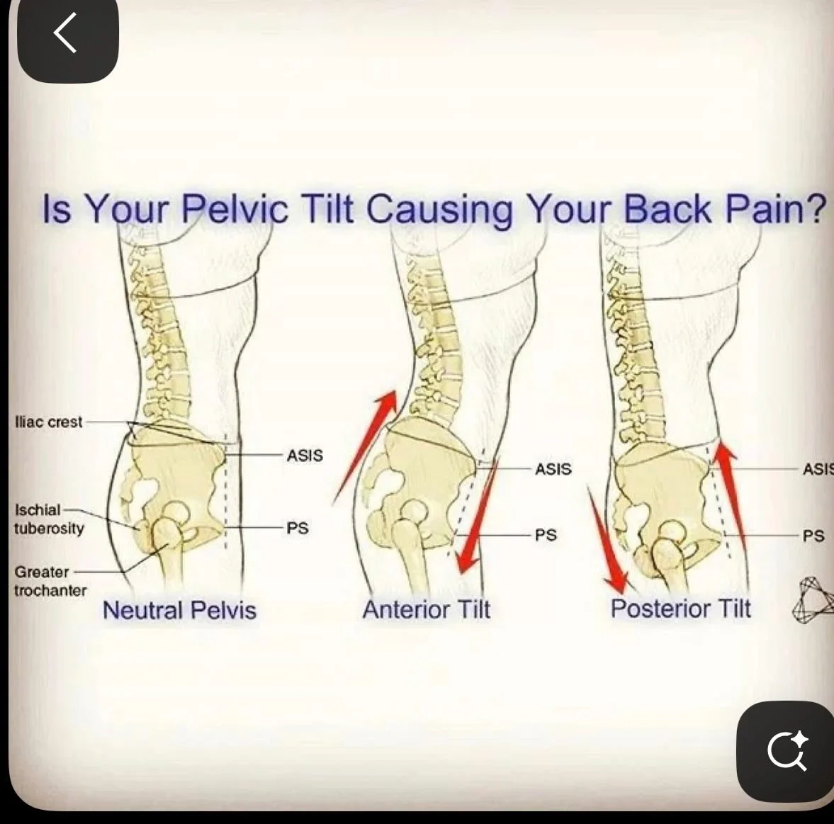 Hips need to be neutral to support the S curve of your spine. Too much anterior or posterior hips will strain lower back