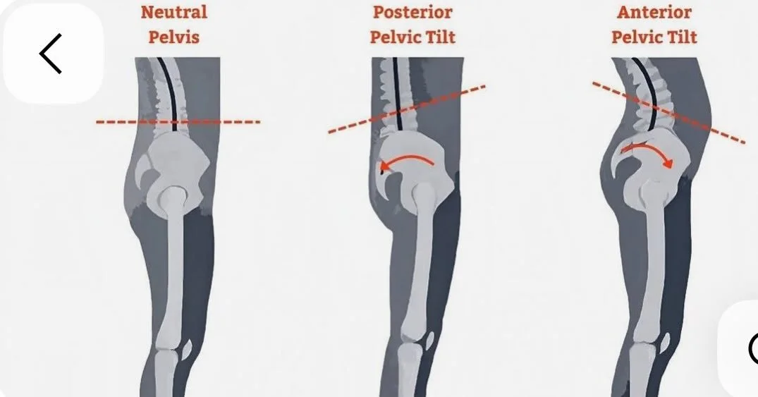 It is important to keep hips neutral to keep the spine to be healthy