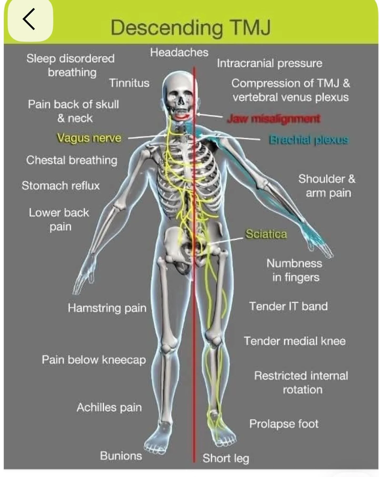 The body works as unit. When the alignment is off, pain can show up anywhere and affects everything.