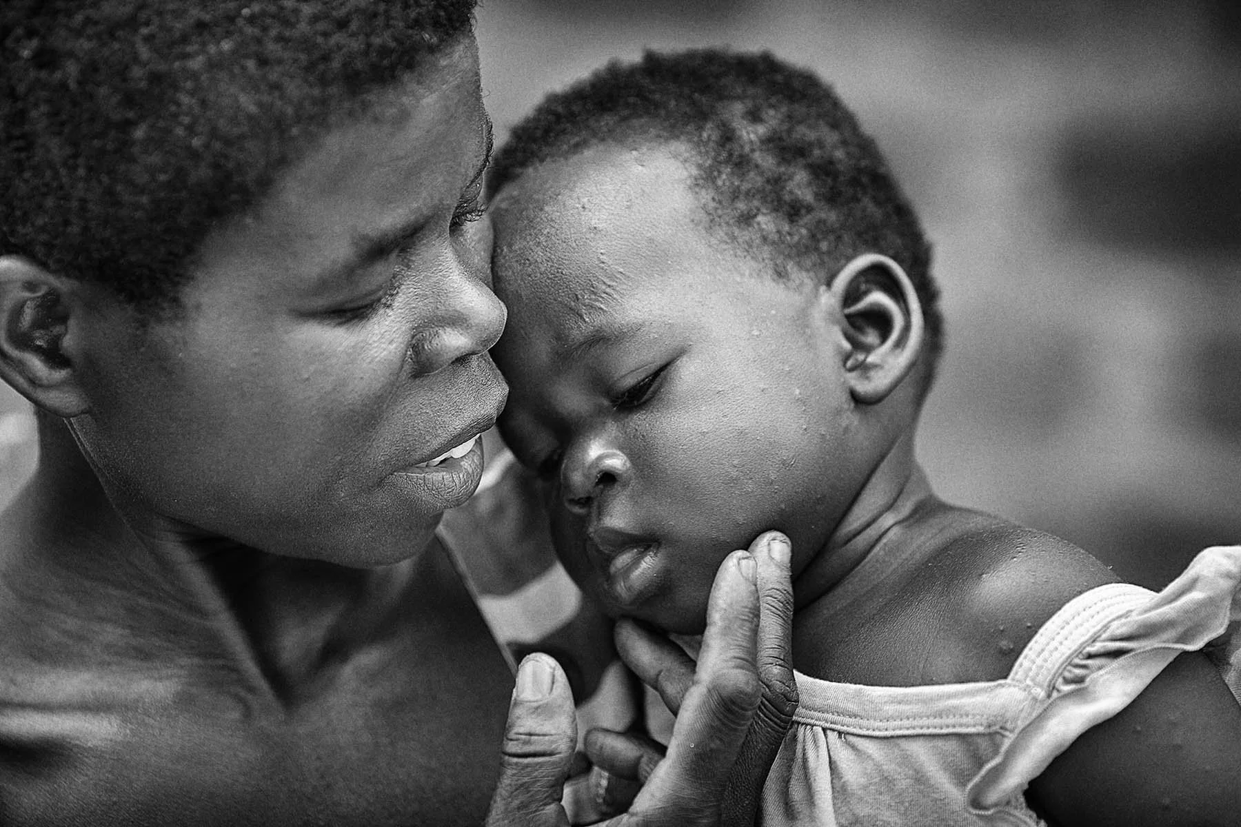 steve-greenaway-black-and-white-photography-documentary-photographer-childs-i-foundation-0001.jpg