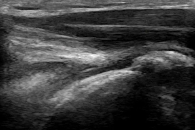 MSK - Musculoskeletal Scans — East Anglia Ultrasound