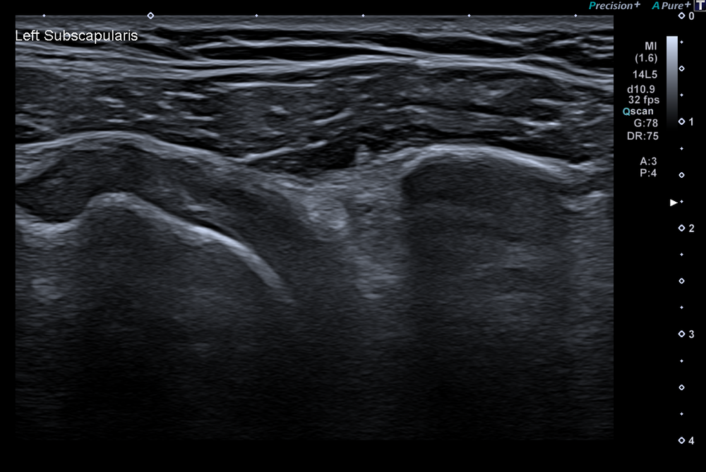 Msk Format MSK - Musculoskeletal Scans — East Anglia Ultrasound