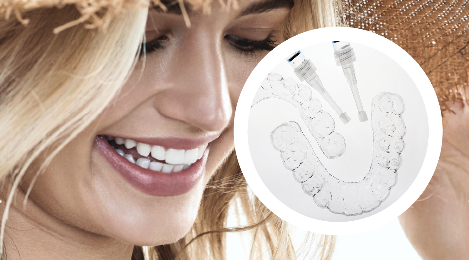 Photo of Custom Whitening Trays