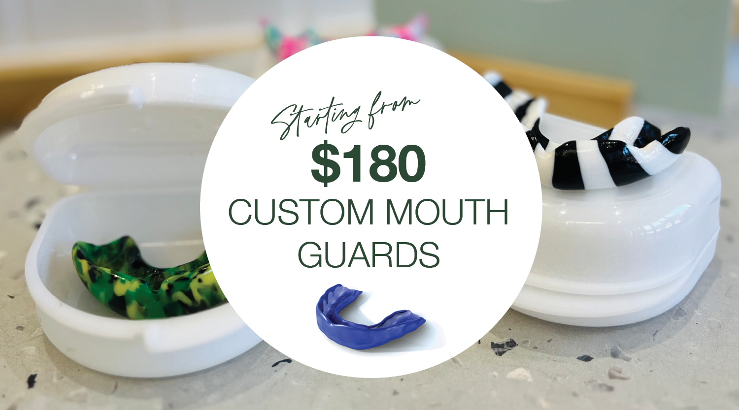 Photo of custom mouthguards with wording starting from $180