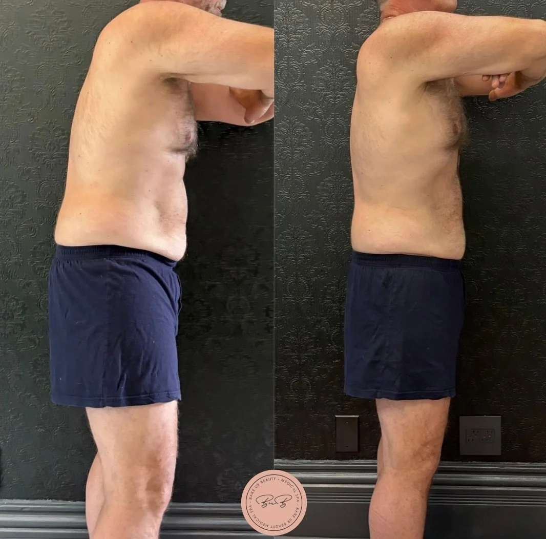 Stronger. Straighter. More confident.

Check out these before and afters of our truFlex client who saw incredible results, not only in how he looks, but how he feels! 

Strengthening his core helped him stand taller, move better, and feel more confid