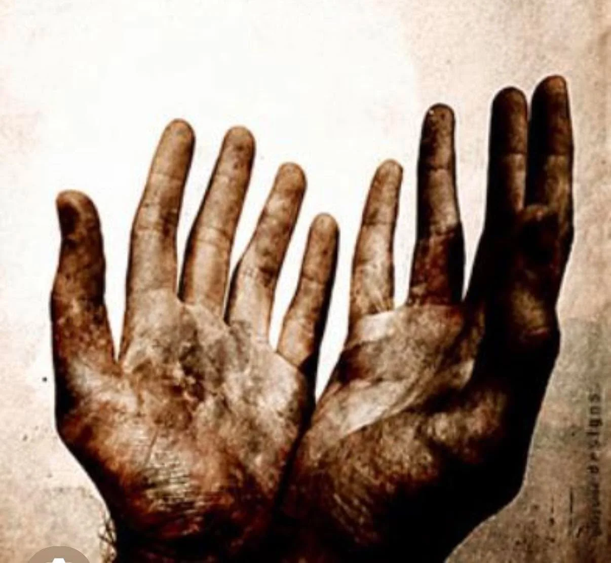 On this Good Friday, I&rsquo;m thinking about scars. 

 Jesus - chose to give His life for us all. He chose the nails. But why do He choose the scars?

At resurrection, He could&rsquo;ve been fully made new. Scars healed and all. 

Sure- the scars we