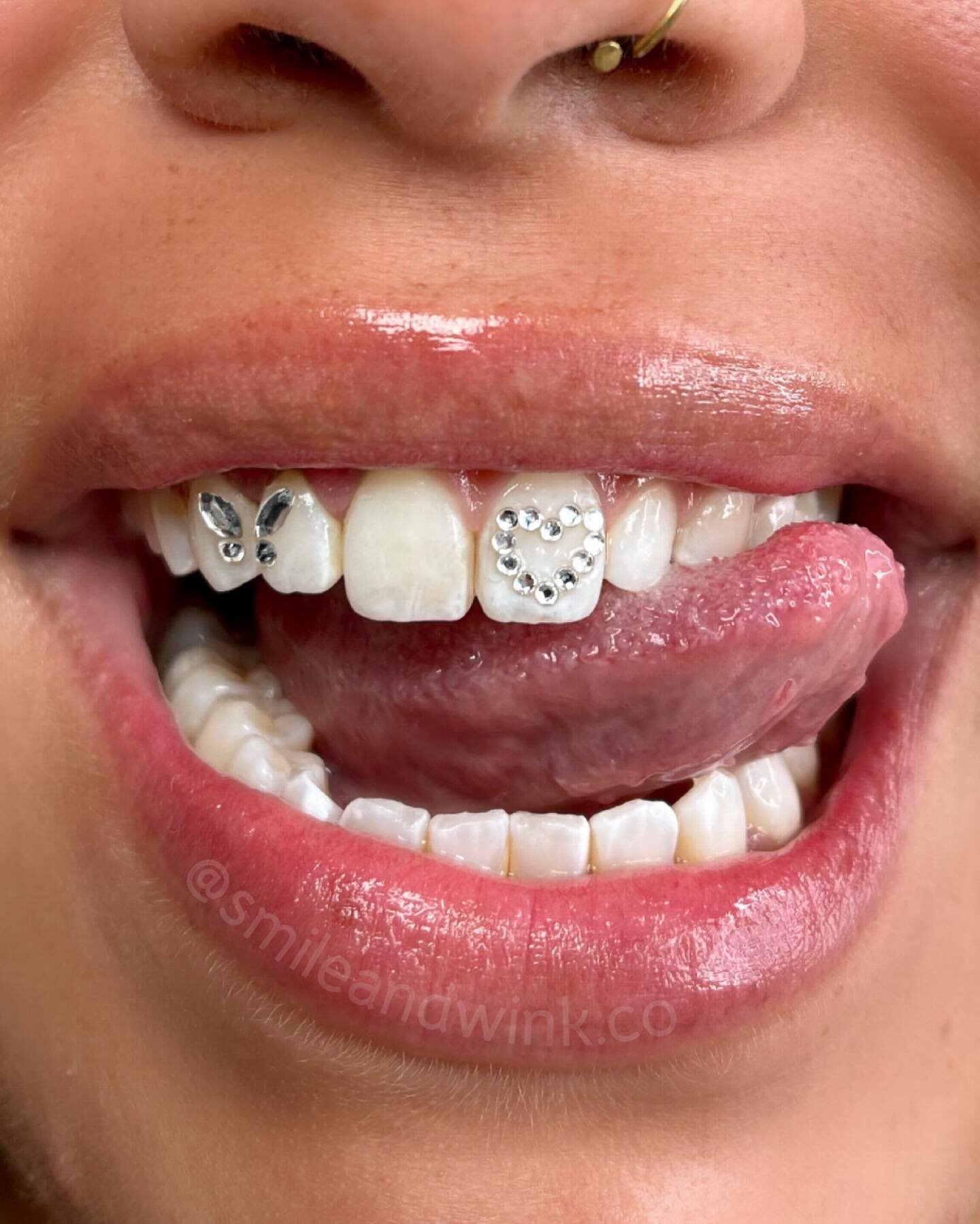 Miami Tooth Gems