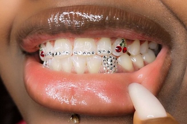 22k Gold Tooth Gems+Swarovski gem  Tooth gem, Diamond teeth, Gold teeth