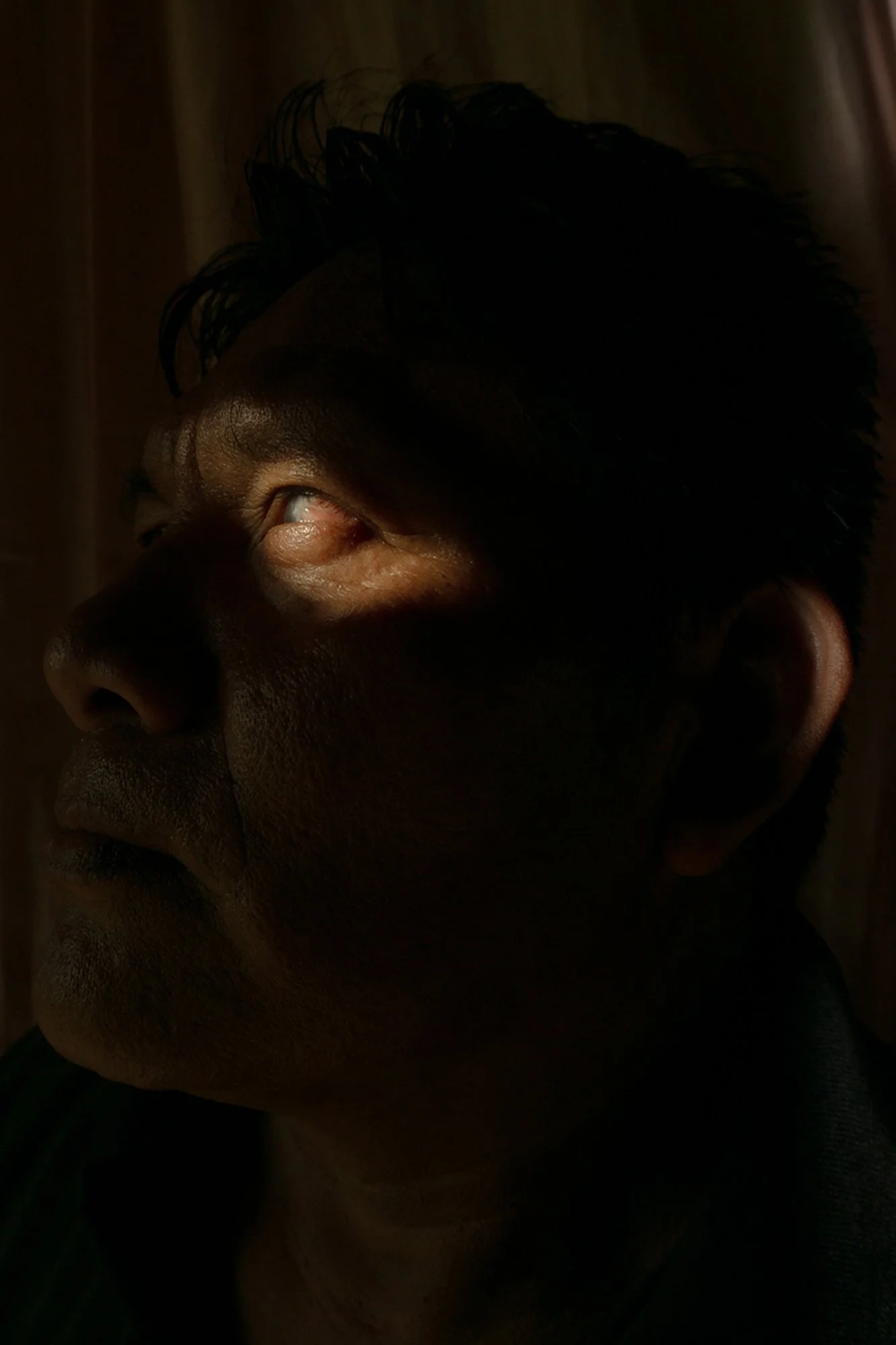 Esteban began working on a banana plantation at an early age. At 37, he started experiencing eye discomfort, unaware that it was caused by years of exposure to agrochemicals. “Del Monte never took responsibility,” he says. Now 49, he lives with parti