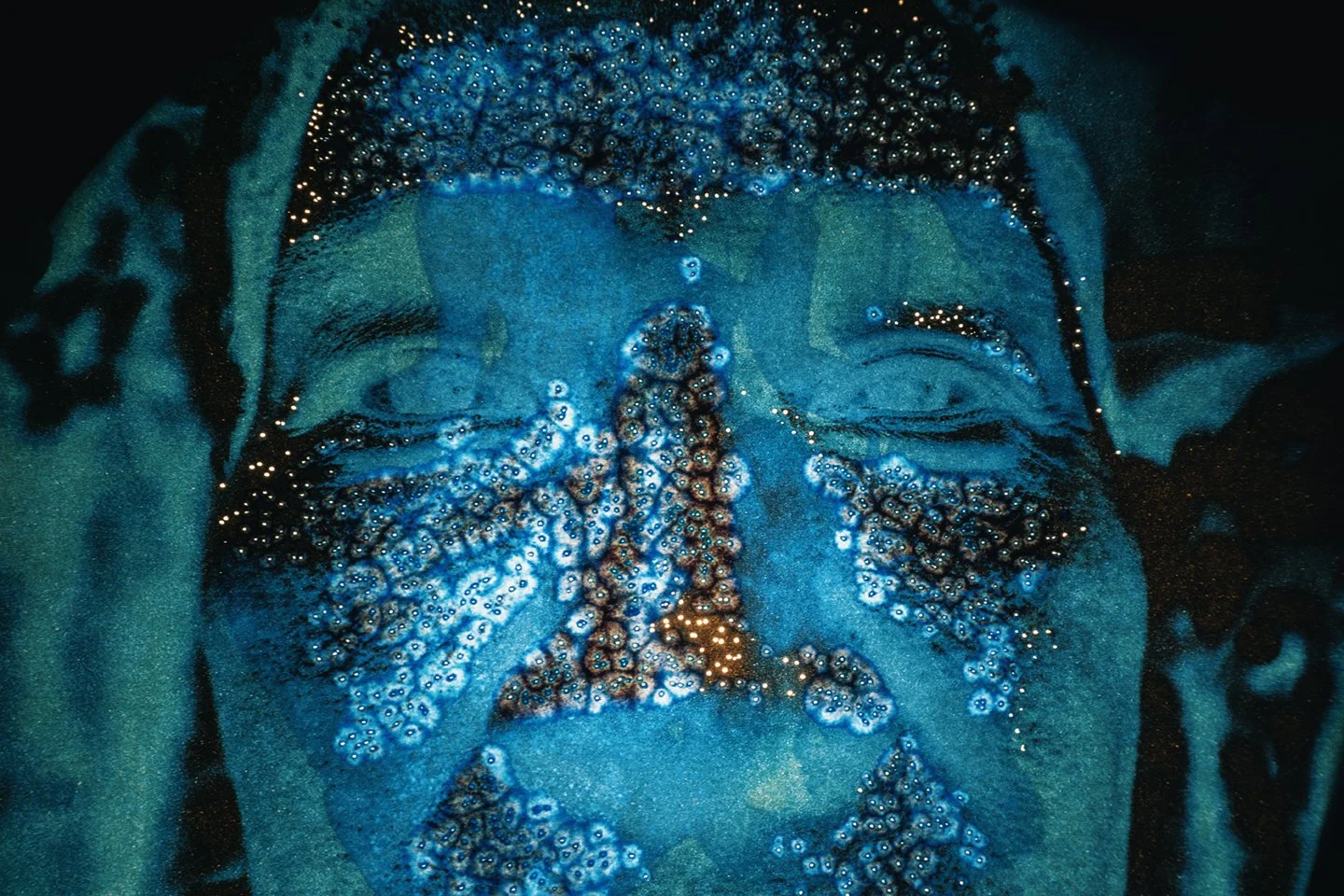 Photograph of a Chiquita Brands International plantation worker showing burns on his face caused by the agrochemicals used within the plantation. The worker describes these burns as feeling like thousands of needles piercing his skin. The photograph 