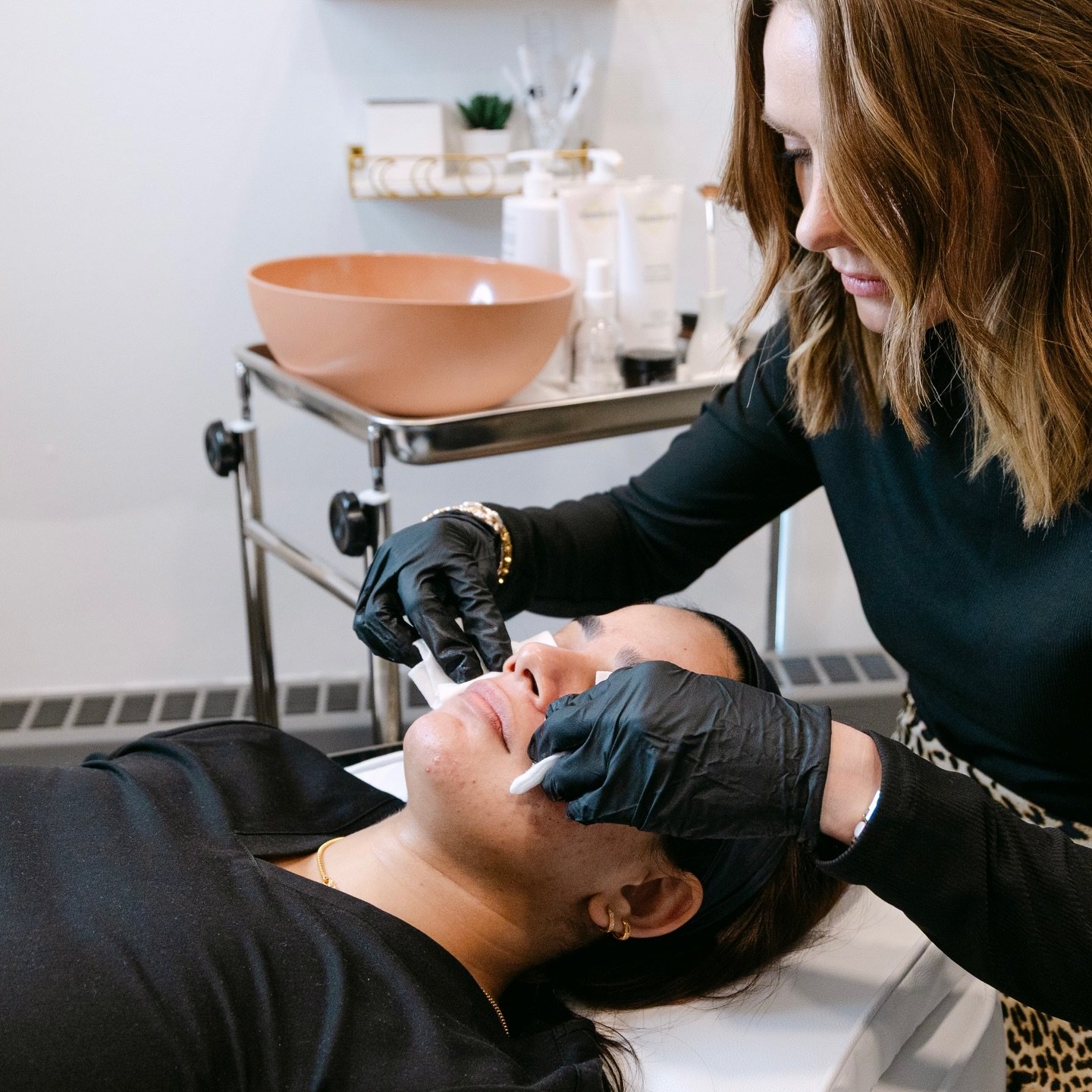 Chemical peels are more than just a cosmetic treatment&mdash;they&rsquo;re a science-backed approach to skin rejuvenation.

As healthcare providers, we customize each peel to your unique skin type, concerns, and goals. Whether addressing hyperpigment