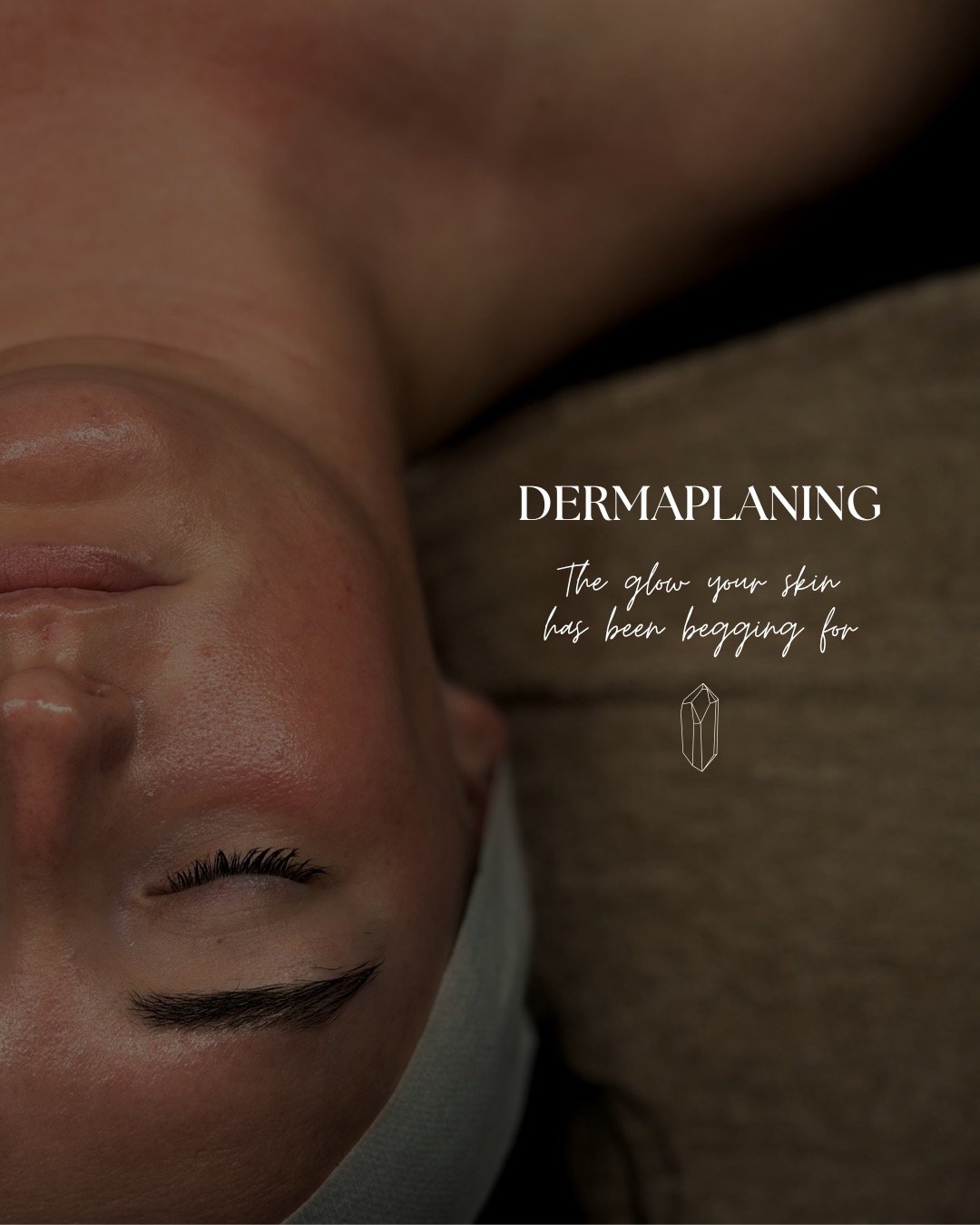 Dermaplaning is one of those treatments that gives instant results without downtime and once you try it, you'll understand why we love it so much✨

Some of the benefits of dermaplaning:
&bull; Removes dead skin buildup for a smoother texture
&bull; H