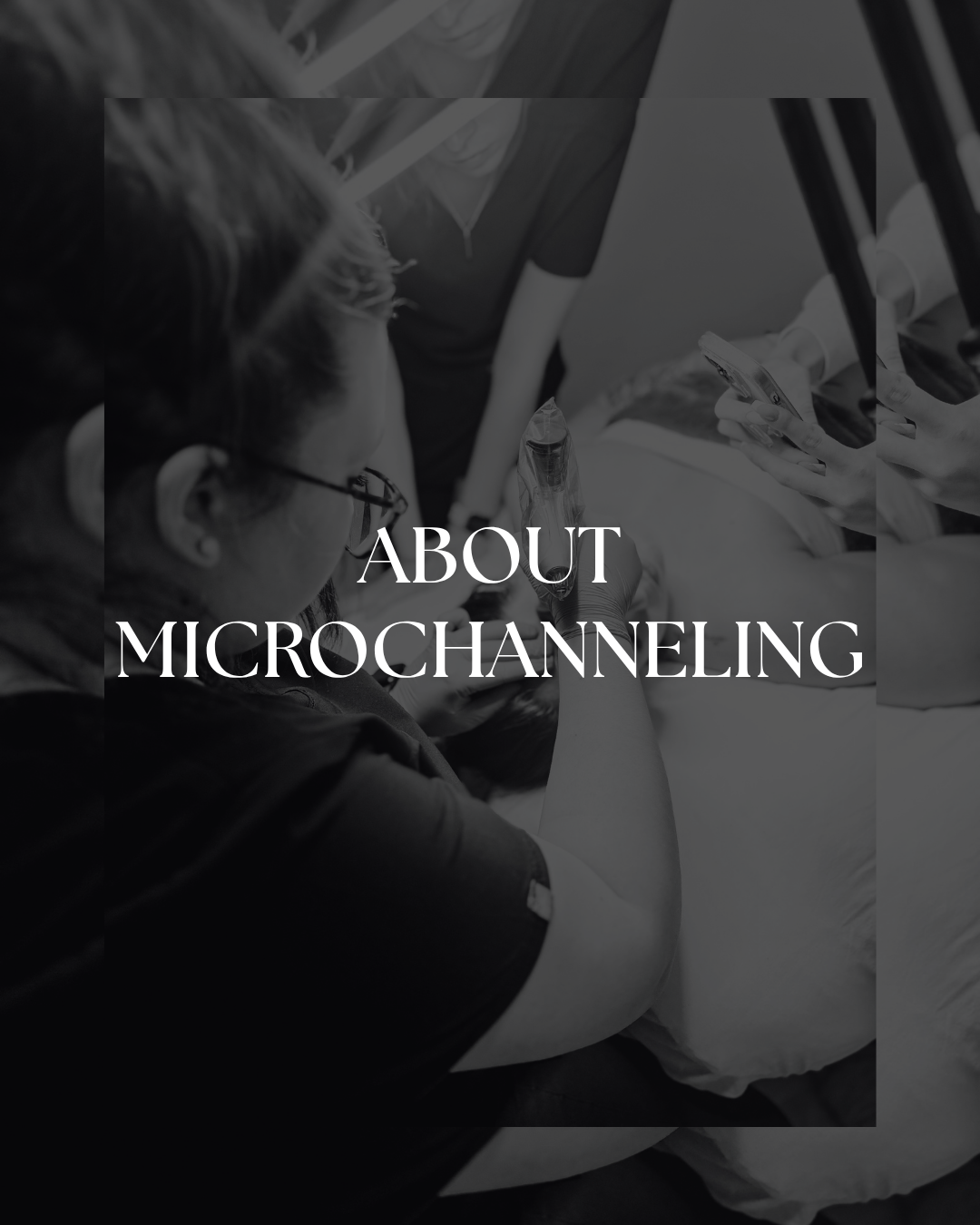 ABOUT MICROCHANNELING