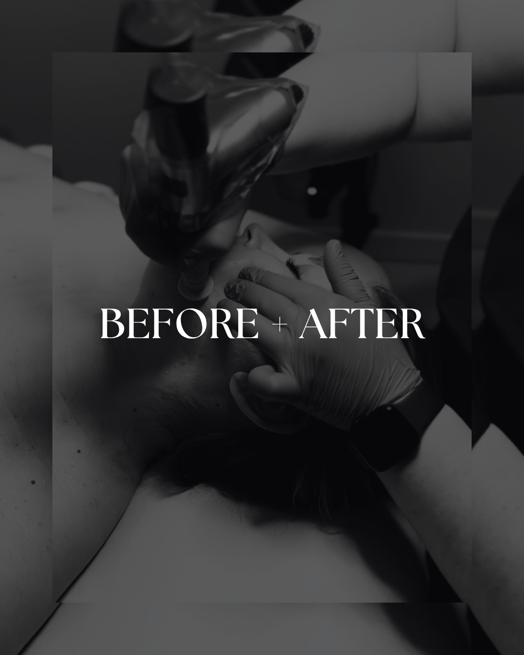 BEFORE & AFTER