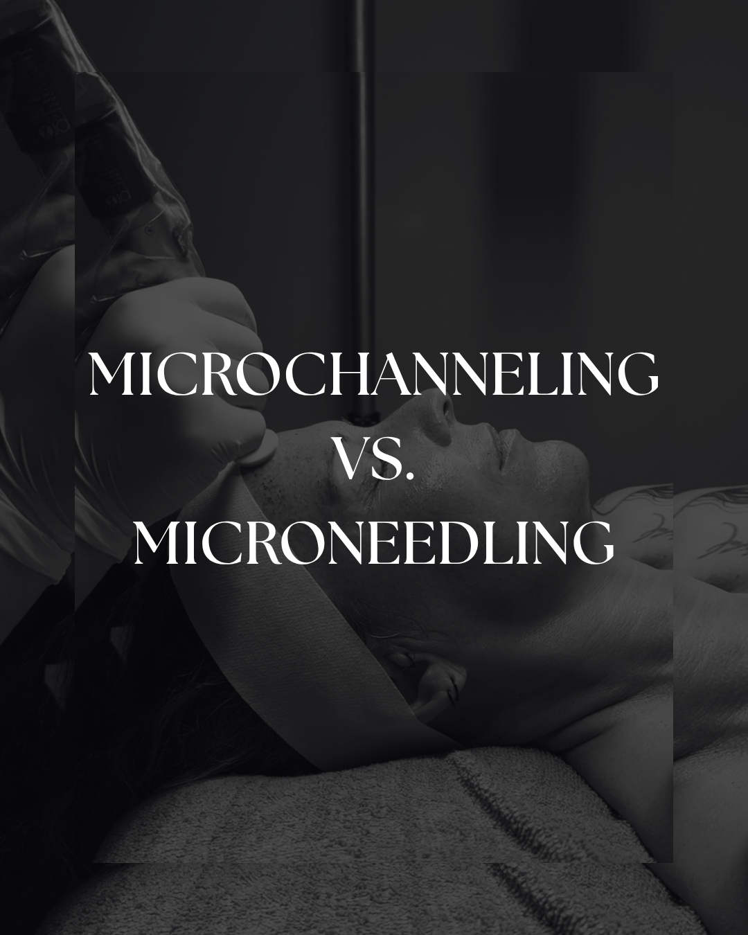 MICROCHANNELING VS MICRONEEDLING