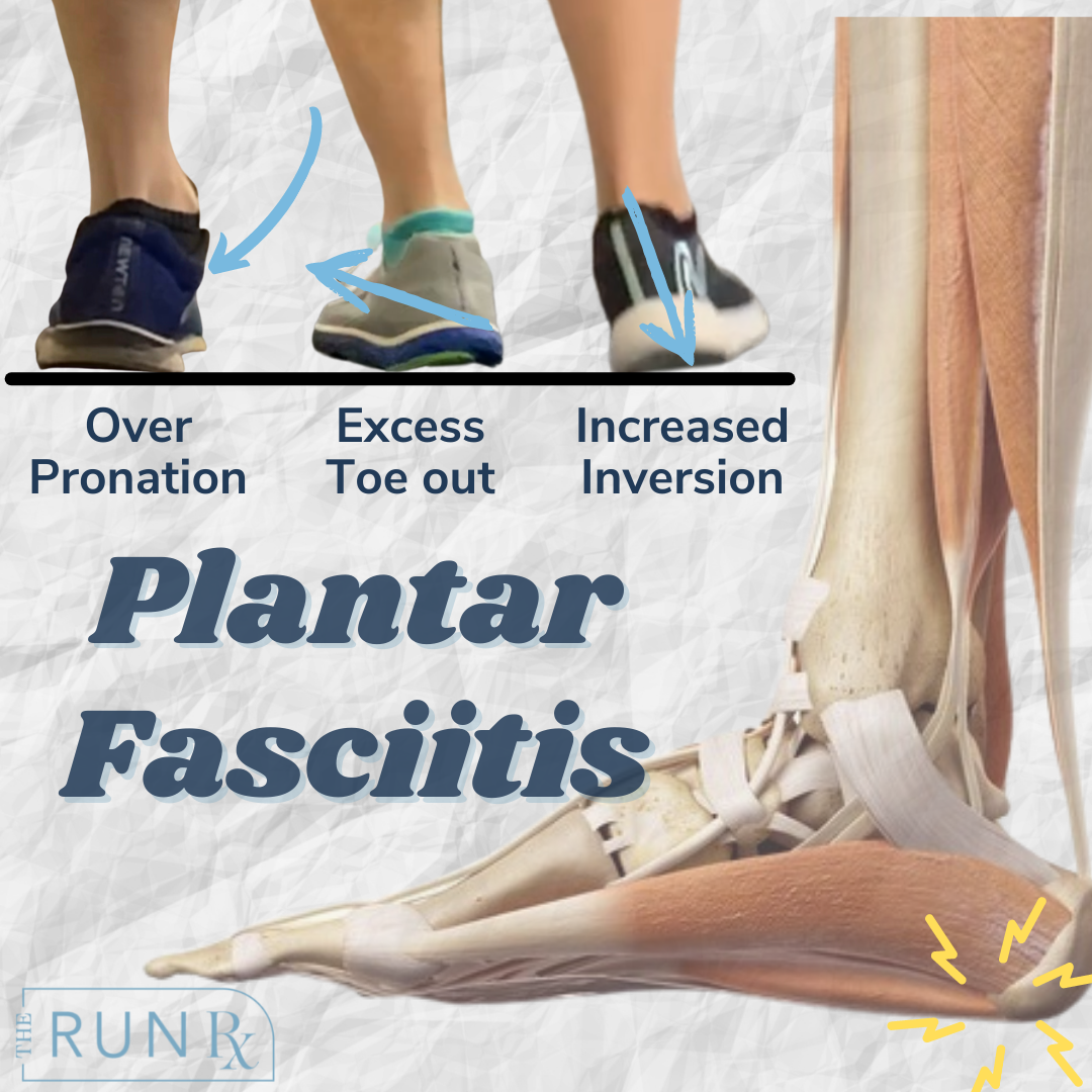 Fasciitis Treatment Heel Hurts After Exercise Fasciitis Treatment