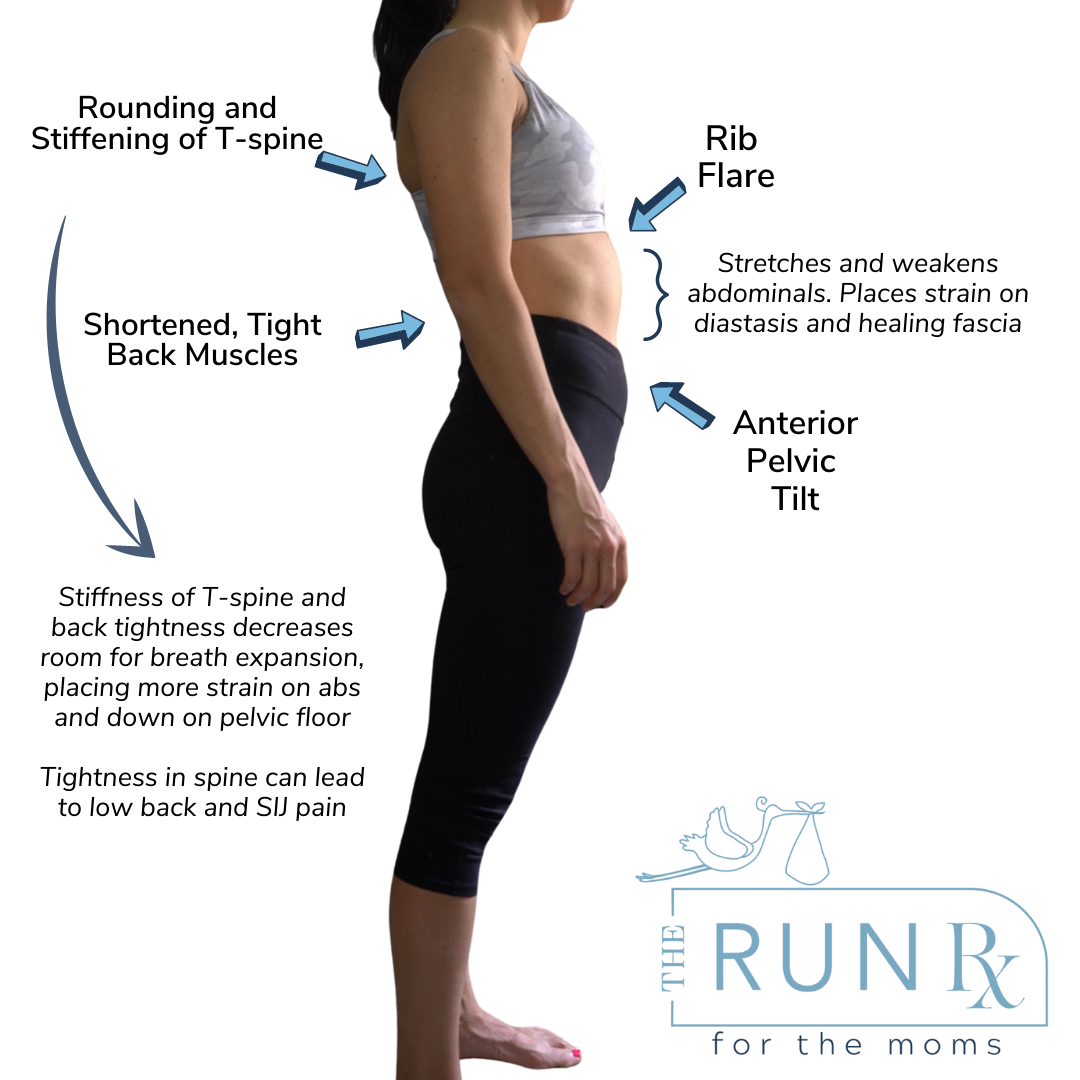 Postpartum Posturing Breathing and Posture in Pregnant and Postpartum Runners — The Run Rx