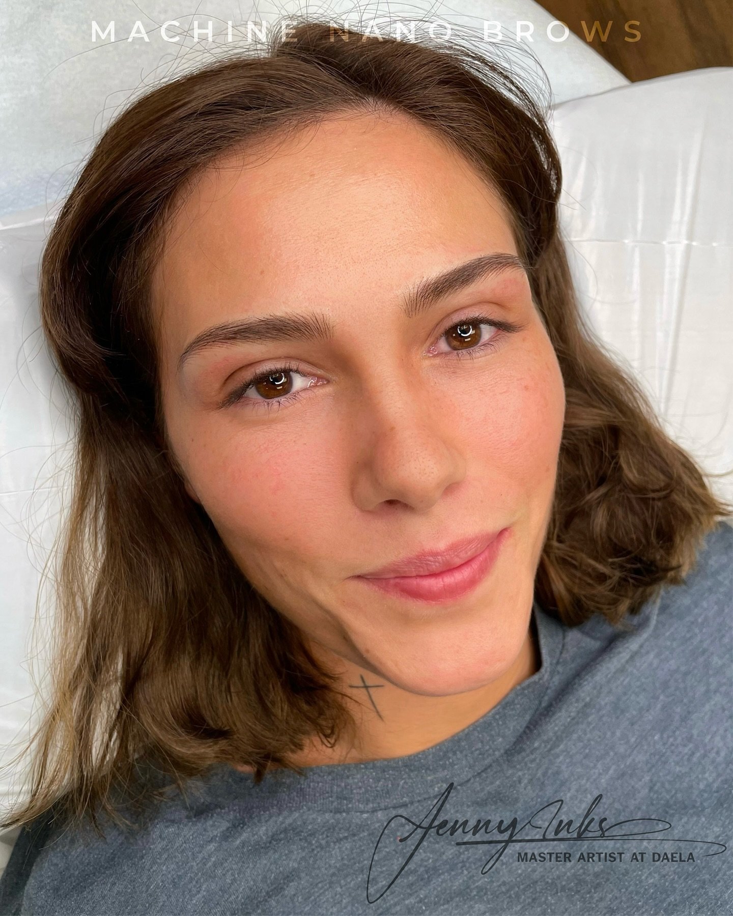 Perfect hairstrokes 🎀

No tails? no problem! Hyperrealism Machine nano hair stroke is custom designed to fit your brows needs. Super fluffy and super natural 🩵

DM me for a free consultation or you can book directly with the link in my bio.

𝗖𝗼𝗻