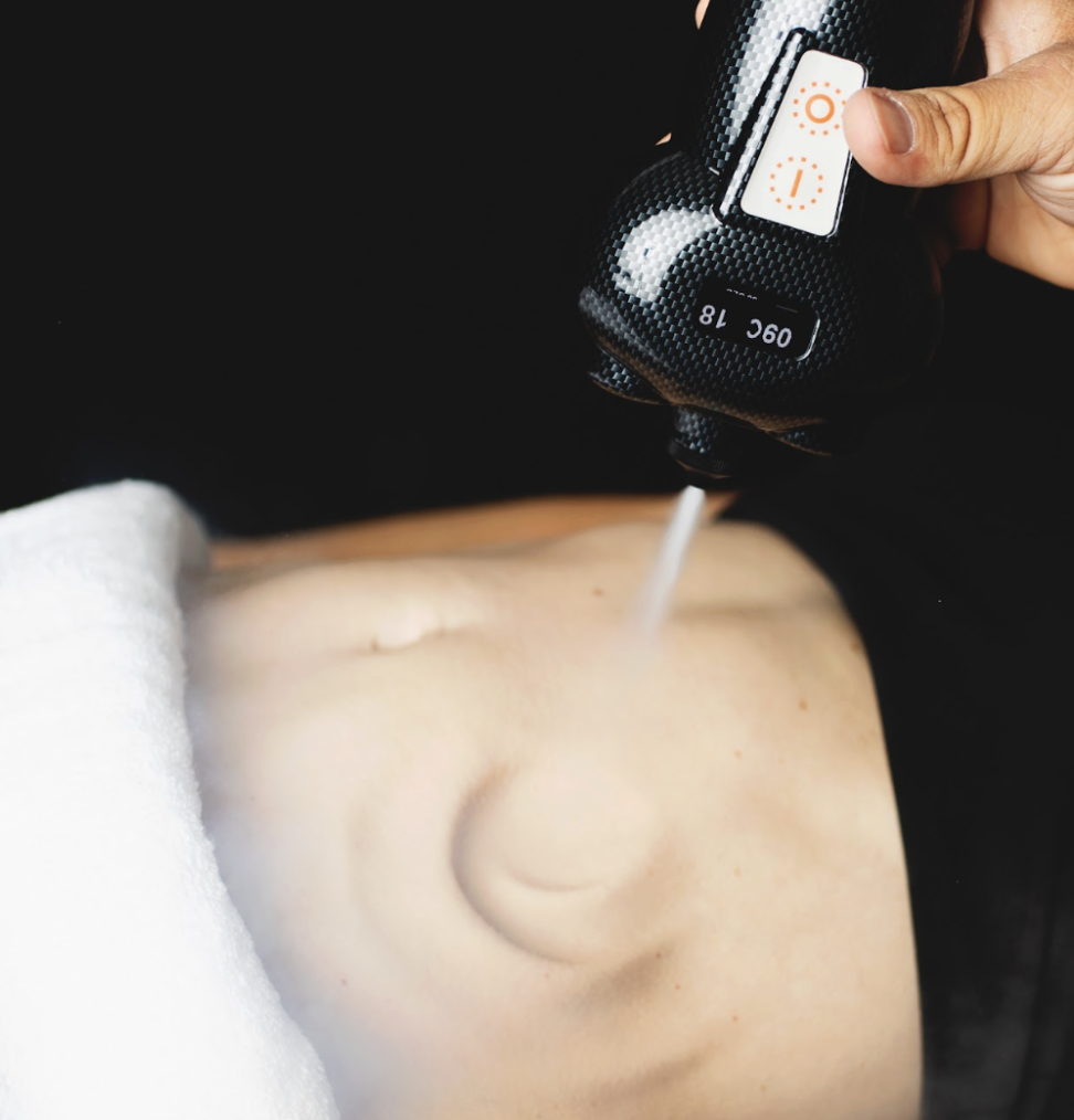 Who Is Cryo-Slimming For?