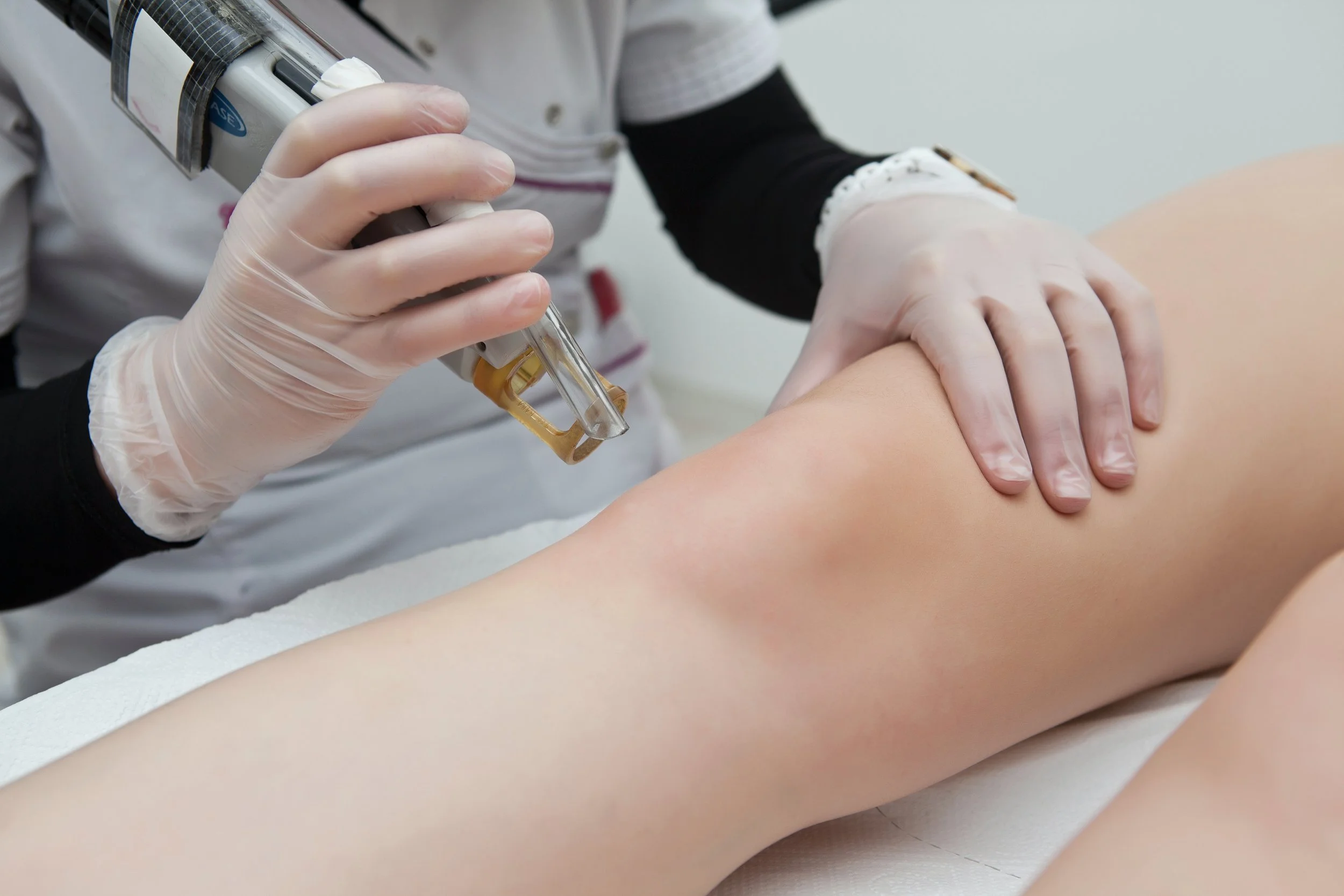 aleksandra_skobel_hair_laser_removal_north_london.jpg